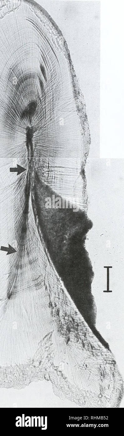 . Die biologische Bulletin. Biologie; Zoologie; Biologie; Meeresbiologie. Mikrosonde KARTEN VON SQUID STATOLITHS 129 bildet einen Winkel mit der seitlichen Kuppel (Ebene 3 in Abb. 2). Und 10 statoliths waren über dem Zellkern gebrochen (Ebene 1 in Abb. 2). Die Oberfläche der Pause wurde dann unter einem Stereomikroskop betrachtet, und nur statoliths mit relativ sauber und auch Flächen für die weitere Vorbereitung angenommen wurden. Die statolith Hälften wurden auf einem Formvar Membran verteilt auf einem dünnen Aluminium Rahmen mit Araldite Rapid Kleber montiert. Ein zweiter Rahmen mit Formvar war auf der Frontfläche des statolith geklebt Stockfoto