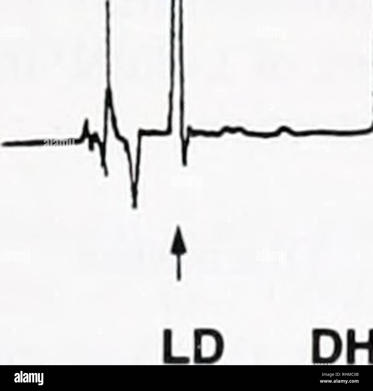 . Die biologische Bulletin. Biologie; Zoologie; Biologie; Meeresbiologie. L-DOPA UND DOPAMIN IN TINTENFISCH 59 Normen g s° SS t t tt LD DHBA DOPAC DA t t tt LD DHBA DOPAC DA. SQUID TINTE T ft DHBA DOPAC DA. Bitte beachten Sie, dass diese Bilder sind von der gescannten Seite Bilder, die digital für die Lesbarkeit verbessert haben mögen - Färbung und Aussehen dieser Abbildungen können nicht perfekt dem Original ähneln. extrahiert. Marine Biologische Laboratorium (Woods Hole, Massachusetts); Marine Biologische Laboratorium (Woods Hole, Massachusetts). Jahresbericht 1907/1908-1962; Lillie, Frank Rattray, 1870-1947; Moore, Carl Stockfoto
