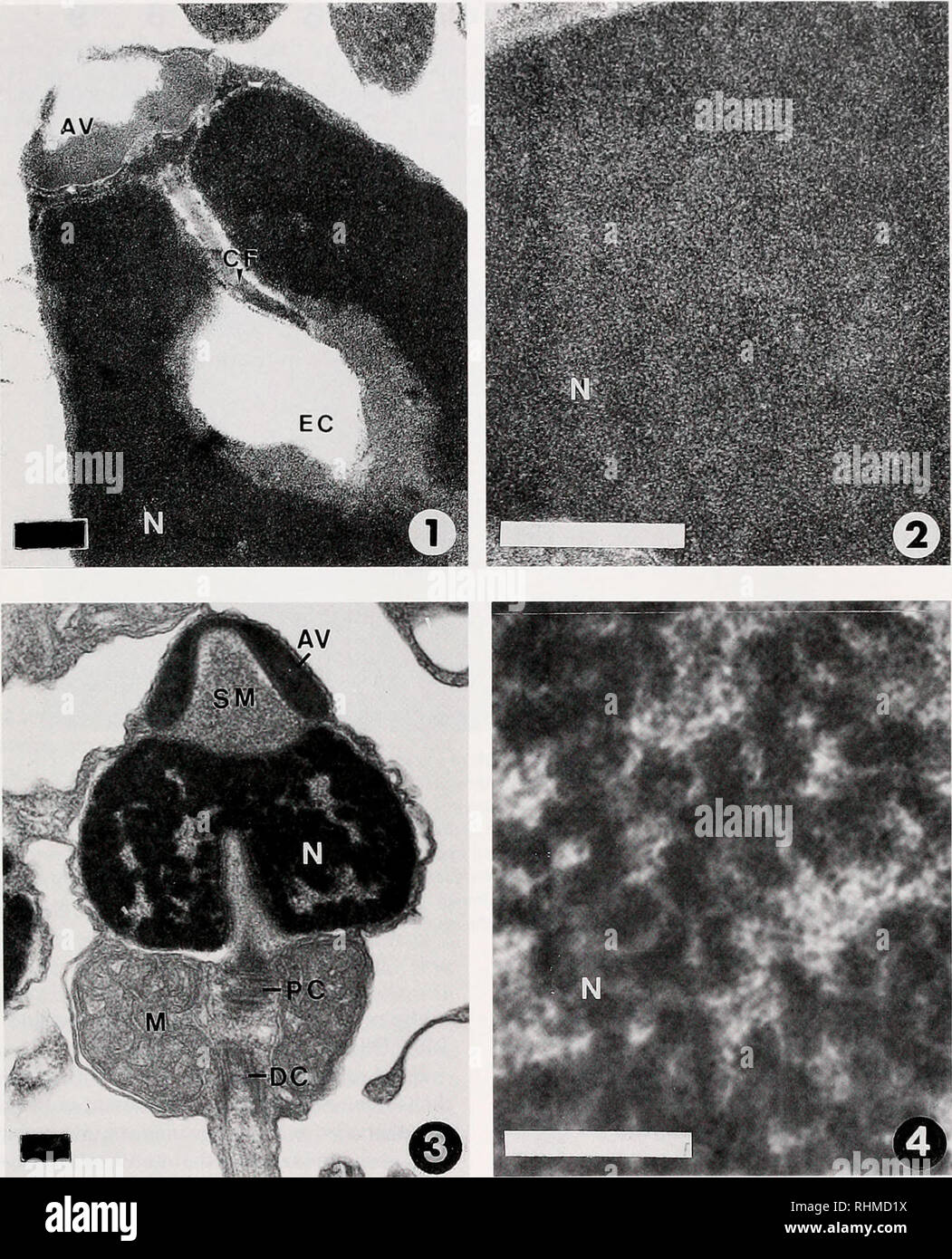 . Die biologische Bulletin. Biologie; Zoologie; Biologie; Meeresbiologie. Chromosomale Samenzellen Proteine der DEUTEROSTOMIERN 109. Abbildung 6. (1) Electron Micrograph der apikalen Region der Spermien von Petromyzon mariaus. angezeigt Die akrosomale Vesikel (AV), die endonuclear Canal (EG) und der zentralen Faser (CF) und dem Kern (N) (X 53.000); (2) Der Kern der Spermien von S. marinus Detail die feine Struktur des Chromatins zu zeigen (X 140.000). (3) Electron Micrograph eines reifen Spermium aus BranchiostomafloridaeacTosoma] Vesikel (AV): distal centriole (DC); Mitochondrien (M); Kern (N); proximalen Cen Stockfoto