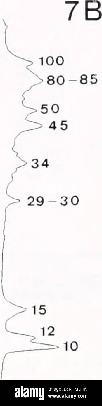 . Die biologische Bulletin. Biologie; Zoologie; Biologie; Meeresbiologie. 14 kDa Abbildung 7. Glykoproteine ot ich Curiums mucnus cephalothoracic Schild Häutchen auf ID-SDS-Polyacrylamid-Gel (5 r/r liegen. 100 Kanne Protein/lane I. electroNotted zu PVDF. Und mit SBA untersucht. Abb. 7 A. Lane M: pre-gebeizt Molekulargewichtsmarker 942 200.000 Molekulargewichtsbereich (GibcoBRU beschriftet mit 14.3 - kDa-Band: Lane I: O.I N HCl-Extrakt: Spur 2:10 r/r-EDTA-etract. Abb. 7B. Densitometrische Profile. Extrahieren, aber die waren viel weniger intensiv beschriftet. Sie waren nicht oder fast nicht nachweisbar in der EDTA-extrac Stockfoto