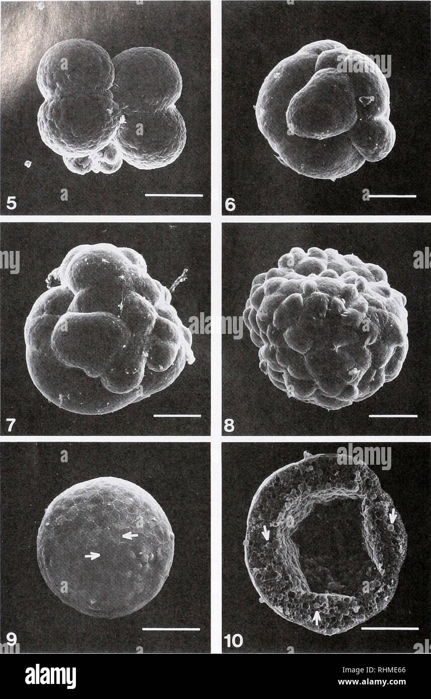 . Die biologische Bulletin. Biologie; Zoologie; Biologie; Meeresbiologie. 350 V J MARTIN ET AL.. FigurtS. 4-Zelle Embryo. Bar = 100 urn. Abbildung 6. Bildung eighl - Zelle embryo von Hydra zeigt zwei ungleiche mittleren Ebenen der Zellen. Bar = 100^m. Abbildung 7. Mitte Spaltung Embryo. Hinweis Die ungleiche Größe der Blastomeren. Zellen am distalen Ende sind kleiner als diejenigen am proximalen Ende Bar = 100 Jim. Zahlen. Ende der Spaltung auf der Bühne. Die Zellen sind mehr einheitlicher Größe und eine morula ähneln. Bar = lOO ^m. Abbildung 9. Coeloblastula. Hinweis Die mikrovilli (Pfeile), dass die Ränder der Zellen abgrenzen. Bar = 100 u Stockfoto