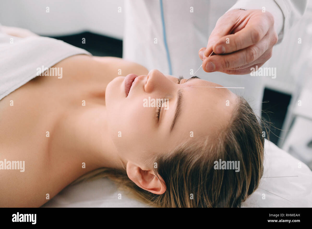 Acupuncturist Einführen einer Nadel in ein weibliches Gesicht Stockfoto