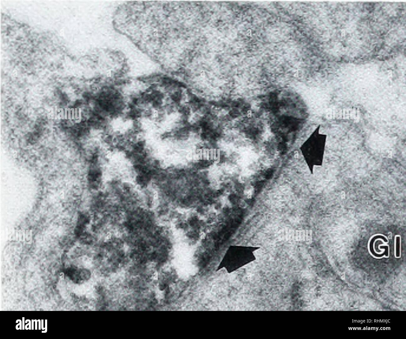 . Die biologische Bulletin. Biologie; Zoologie; Biologie; Meeresbiologie. NEUROMODULATION IN APLYSIA 257. Gl Gl Abbildung 7. Electron Micrograph durch die Zelle hod&gt; eines pleural sensorischen Neuron zur Veranschaulichung ein direkter Kontakt zwischen einem Serotonergen Prozess und die Plasmamembran ol die sensorischen Neuron. Die prä- und postsynaptischen Membran (pfeilspitzen) und die verbreiterte synaptischen Spalt deuten darauf hin, dass dieser Abschnitt wird durch die aktive Zone, ein möglicher Standort des Senders lösen. Zahlreiche Gliazellen Prozesse (GI) invagmate der sensorischen Neuron Membran. Pleural Ganglien wurden behoben und in der Grundschule inkubiert. Stockfoto