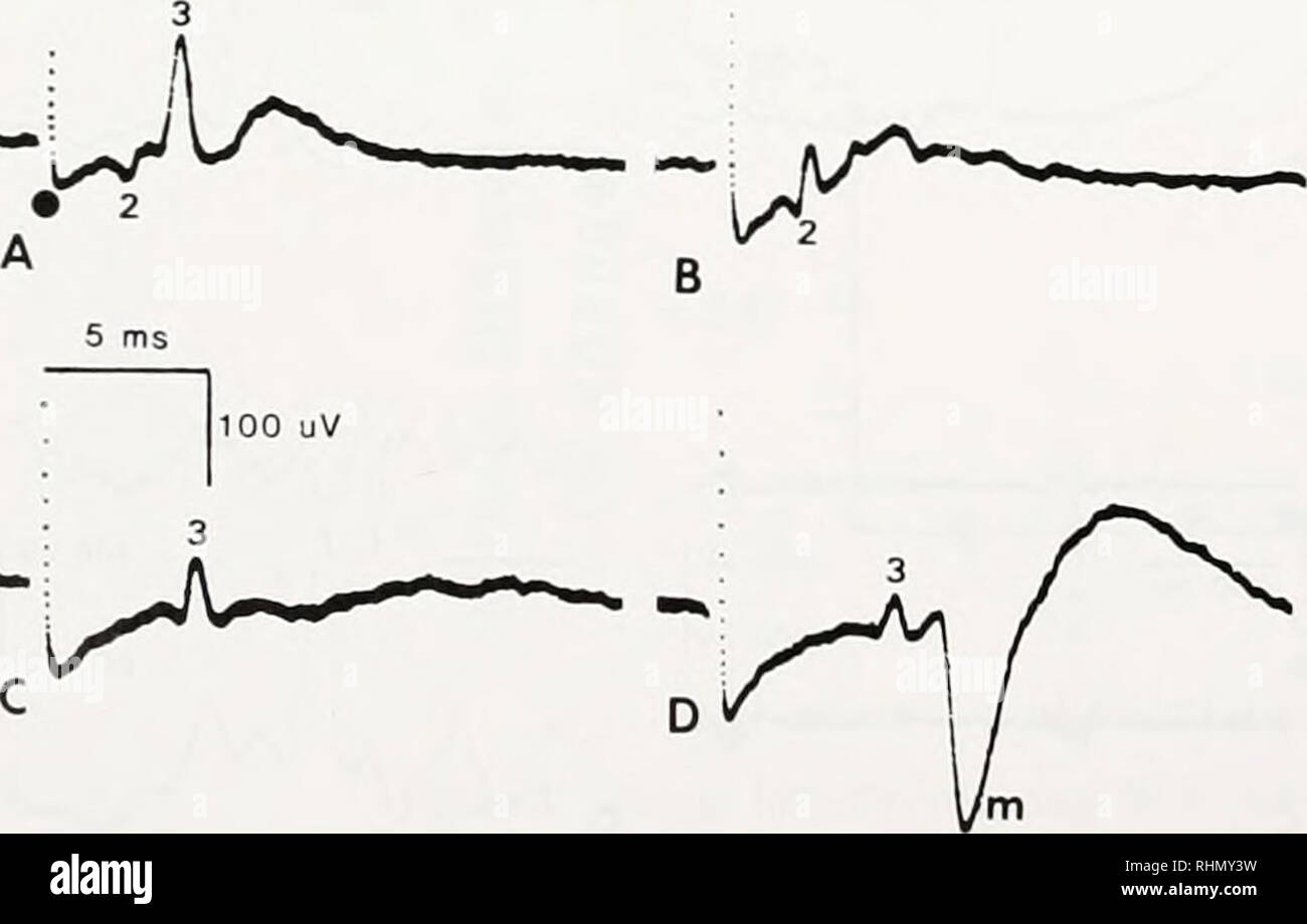 . Die biologische Bulletin. Biologie; Zoologie; Biologie; Meeresbiologie. 216 W. F. GILLY ET AL. in der riesigen Motor Systeme. Abbildung 6a zeigt, wie Aufzeichnungen aus einem Stufe 29+ Embryo. Riesige Faser Erregung ist in - durch eine erste kleine, negative, Spike (2) fol dicated - folgten durch einen größeren positiven Ereignis (3). Wie oben besprochen, die erste Komponente (2) Repräsentiert die Ankunft der Impuls, in der zweiten um riesige Fibre Eingabe der stellate gan-glion über die pallial Nerv, in der Erwägung, dass die zweite Komponente (3) die summierte Aktionspotenziale von proximalen Teile des Dritten - bestellen Riesen spiegelt in liegend Stockfoto