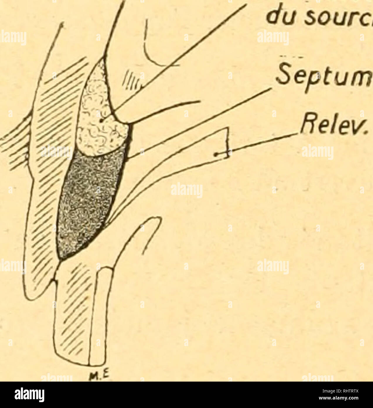 . Bibliographie anatomique. Die menschliche Anatomie, Histologie, Embryologie, Human. Relev. Röhre Le sourcil. Abb. 2.  Injektionen superficielles. A. Injektion aous - cutauà © e abondante Simulanzlösemittel un Åil pochà ©. L'injection Faite en avant de l'orbiculaire eine traveraà © le Muskel qui est noyé dans la Bisbal. Une petite Partie de l'injection, Dekor colorée, ein transsudà ©: en haut, en ar-rière du "eptiim orbitaire, Le Long de Sohn accolemi-nt au releveur; en Bas, en avant de Tarse, B. Injektion sous-mnsculaire dan "l'espace pré septal. L'injection, poussée en très petite quantité, est contenue entre le Cou Stockfoto