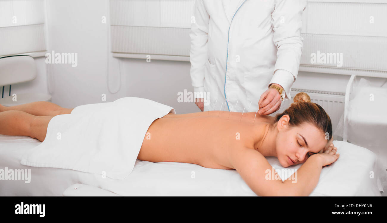 Frau mit Akupunktur Behandlung auf ihr zurück Stockfoto