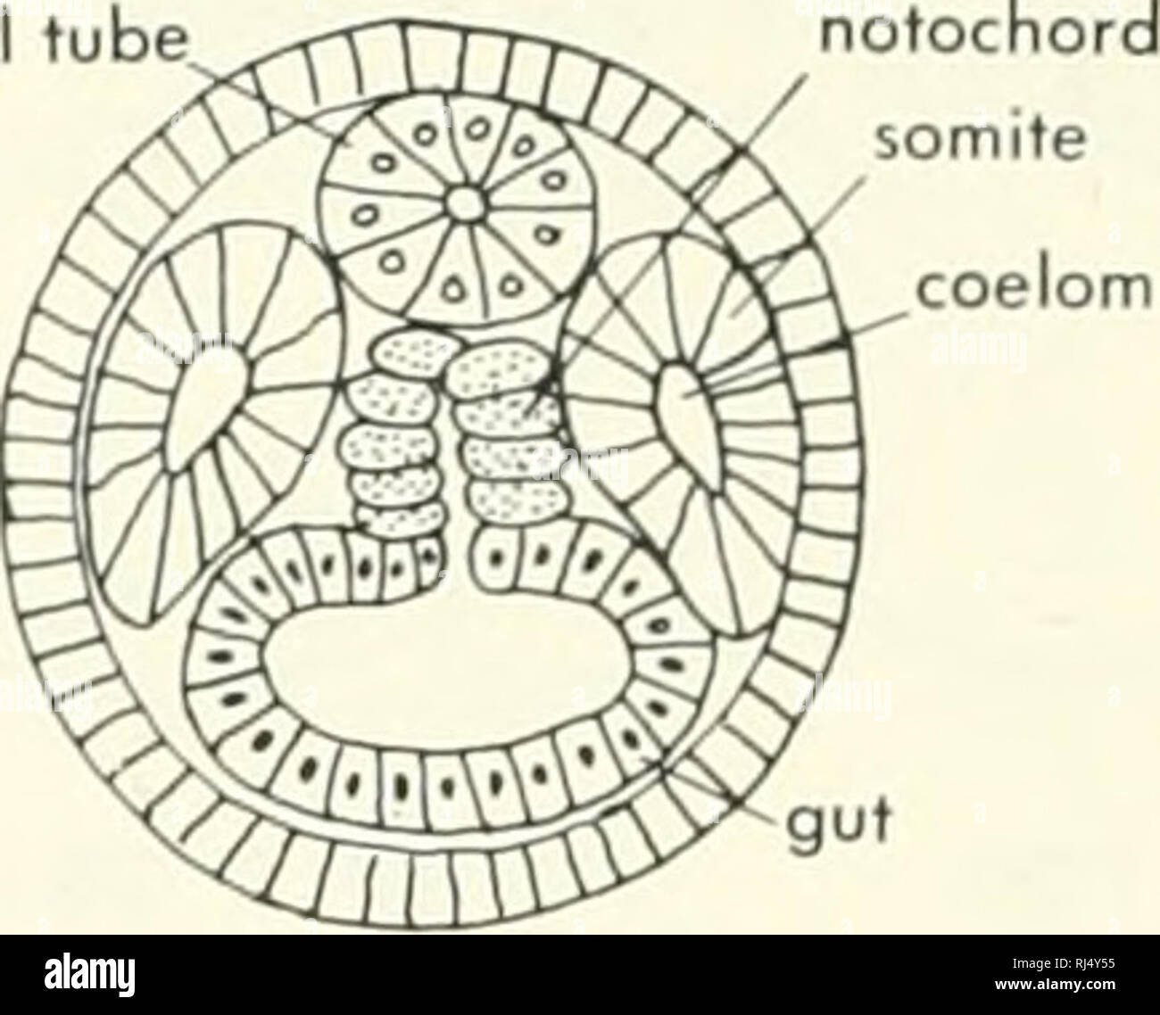 Diverticula Stockfotos & Diverticula Bilder - Alamy