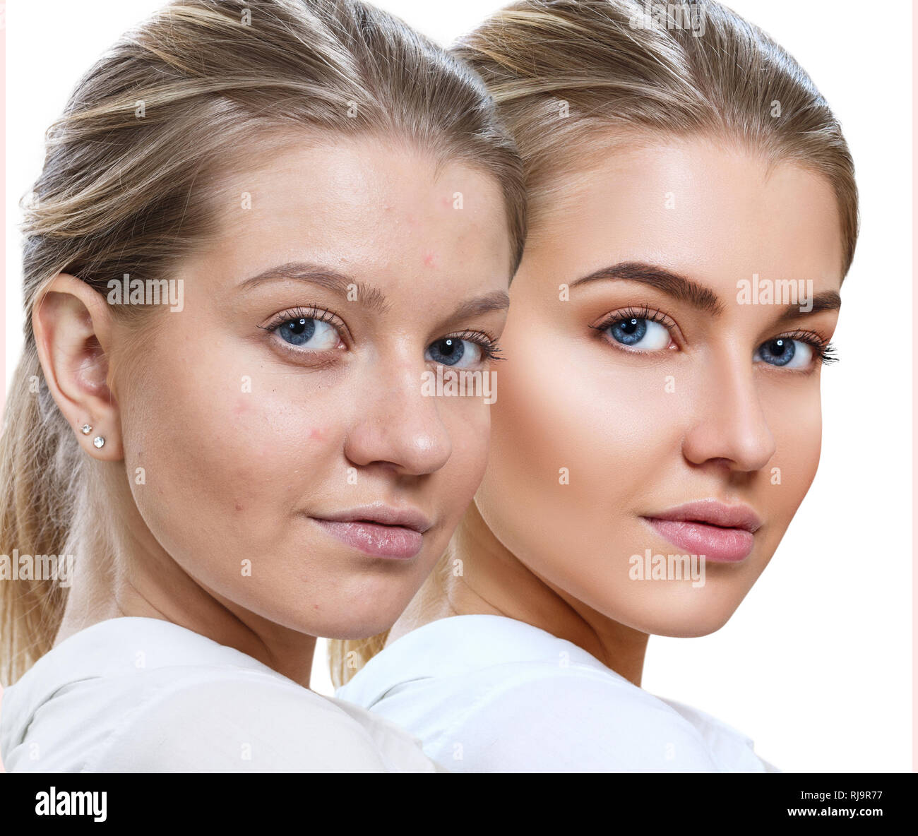 Junge Frau vor und nach der Hautpflege und Make-up. Stockfoto
