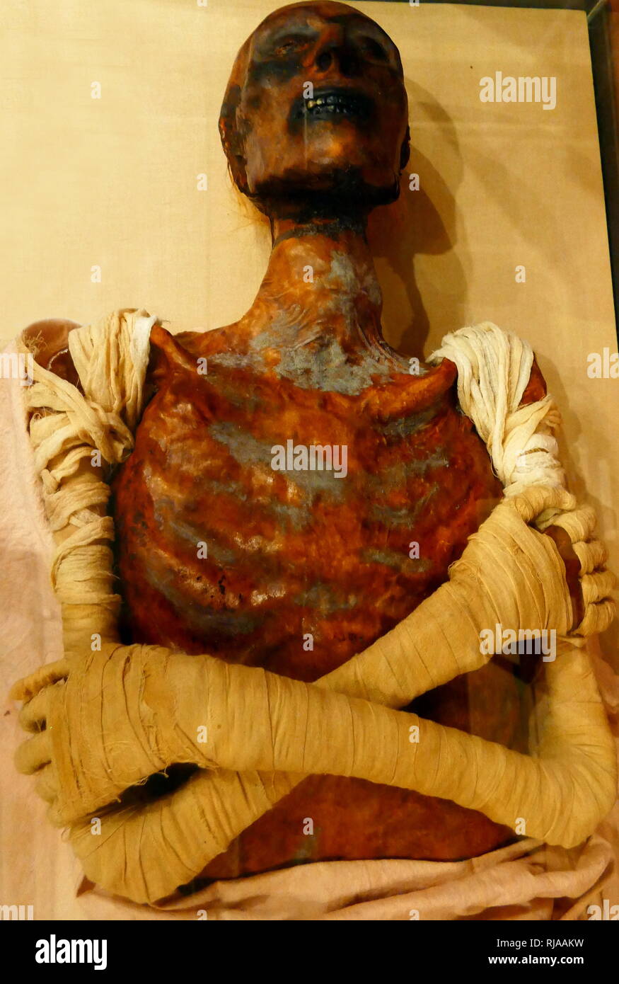 Replik der Mumie von Ramses II (1303 v. Chr. - 1213 v. Chr.). Ramses regierte als König von Ägypten (1279-1213 v. Chr.). Bekannt als Ramses der Große, war der dritte Pharao der 19. Dynastie. Mumie des Pharao offenbart eine gekrümmte Nase und kräftige Kiefer. Es liegt bei etwa 1,7 m (5 ft 7 in).[67] Gaston Maspero, erste ausgepackt, die Mumie von Ramses II. Die mikroskopische Untersuchung der Wurzeln von Ramses II Haar bewies, dass der König Haare ursprünglich rot war, was darauf schließen lässt, dass er aus einer Familie von redheads. 1974 Ägyptologen sein Grab besuchen festgestellt, dass der Zustand der Mumie war r Stockfoto
