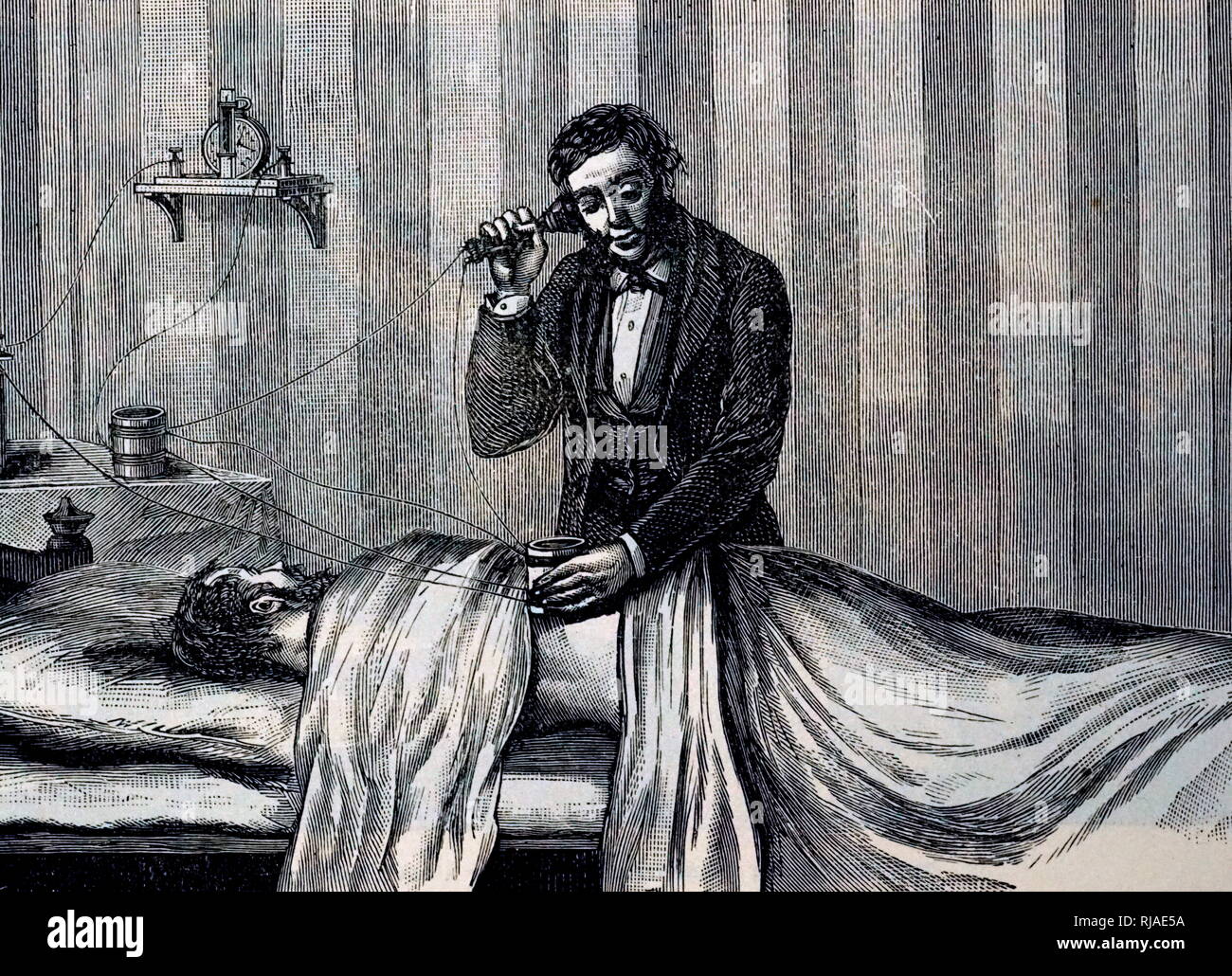 19 Abbildung: ein Chirurg mit einer Induktion Balance und Headset mit Mikrofon zu einem bullet Lokalisieren. Dies wurde durch David Edward Hughes 1830-1900 erarbeitet. Stockfoto