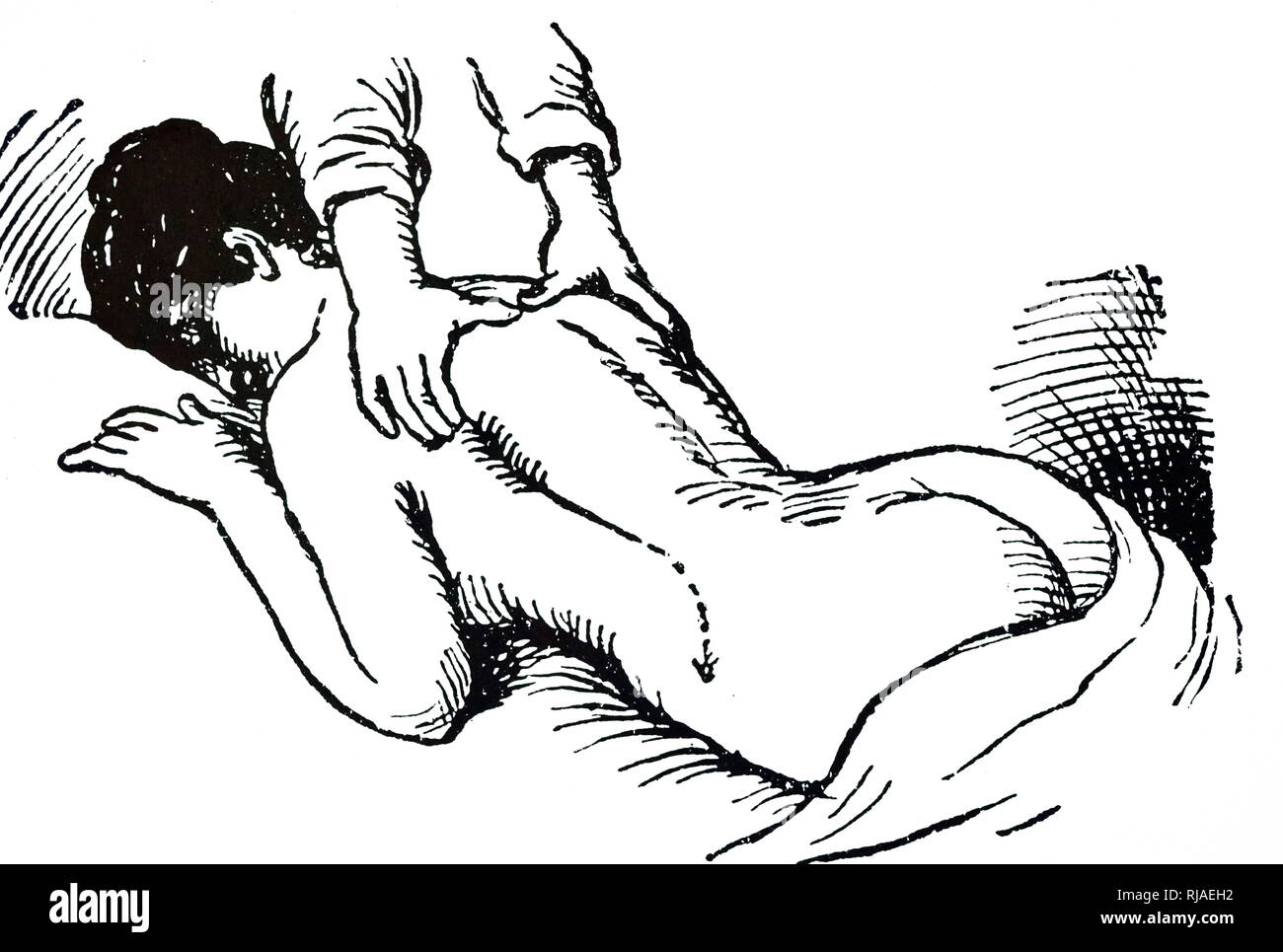 Eine Gravur, eine Massage der Schultern nach unten. Vom 20. Jahrhundert Stockfoto