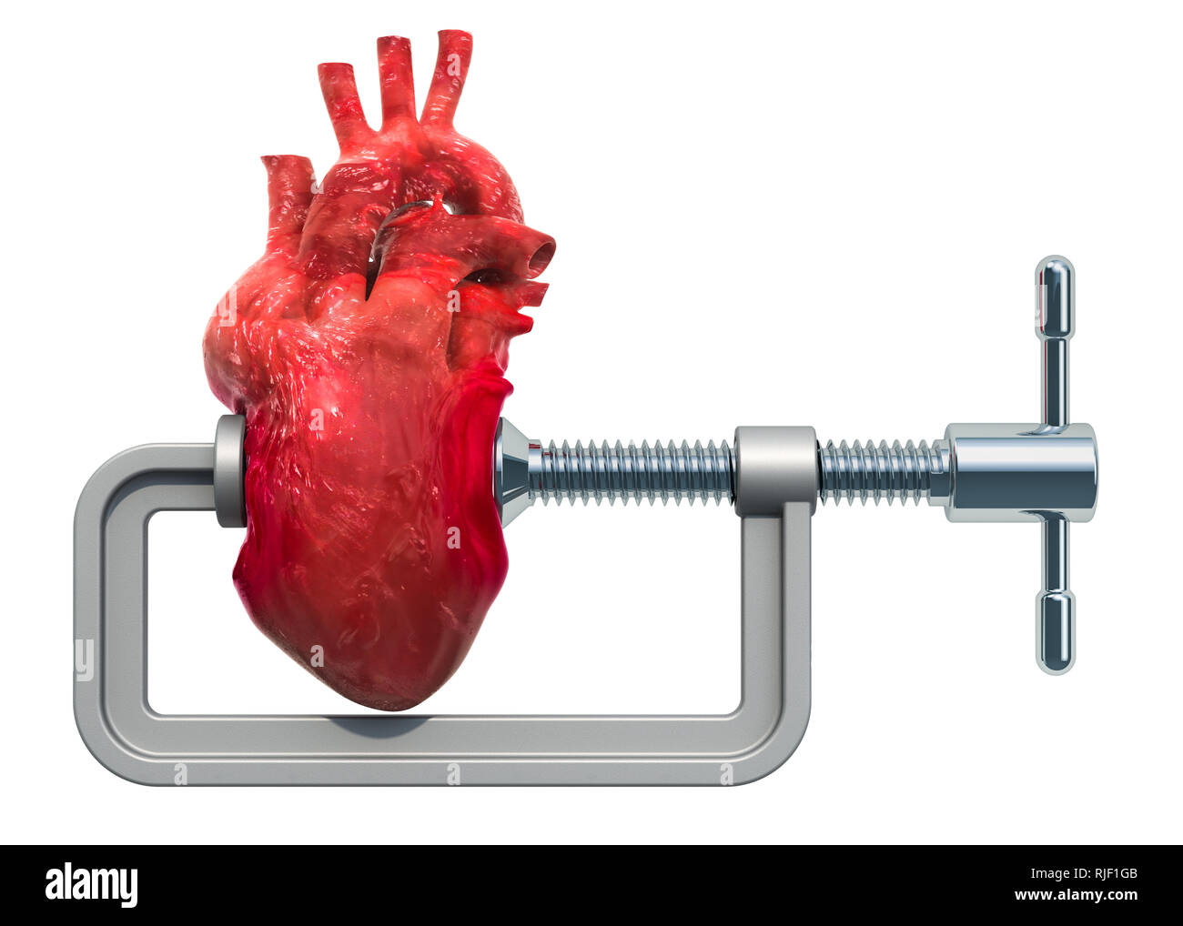 Herzinfarkt, Herz-Konzept. Schraubstock mit menschlichen Herzen. 3D-Rendering auf weißem Hintergrund Stockfoto