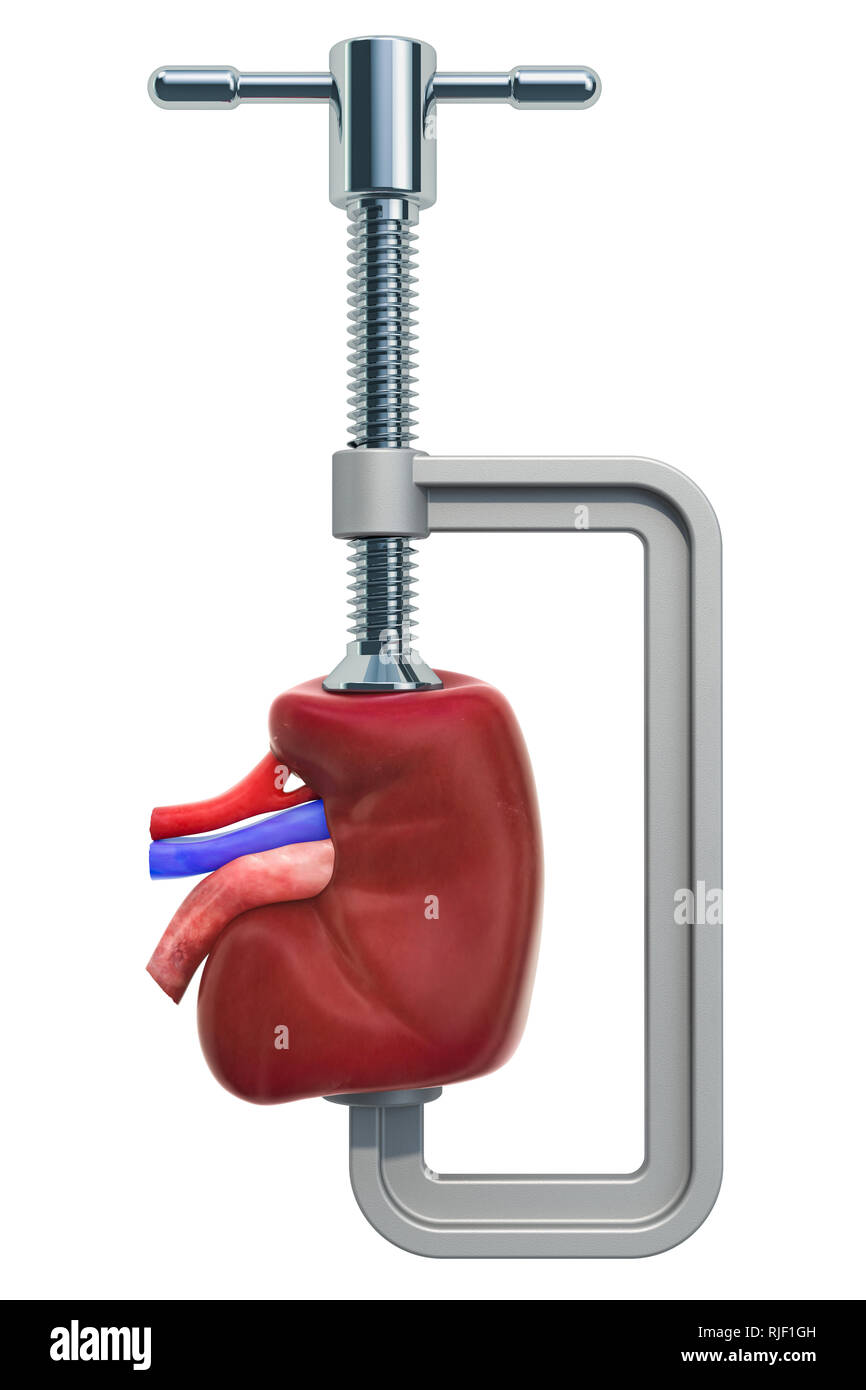 Schmerzen in den Nieren, chronischen Nierenerkrankungen Konzept. Schraubstock mit Niere, 3D-Rendering auf weißem Hintergrund Stockfoto