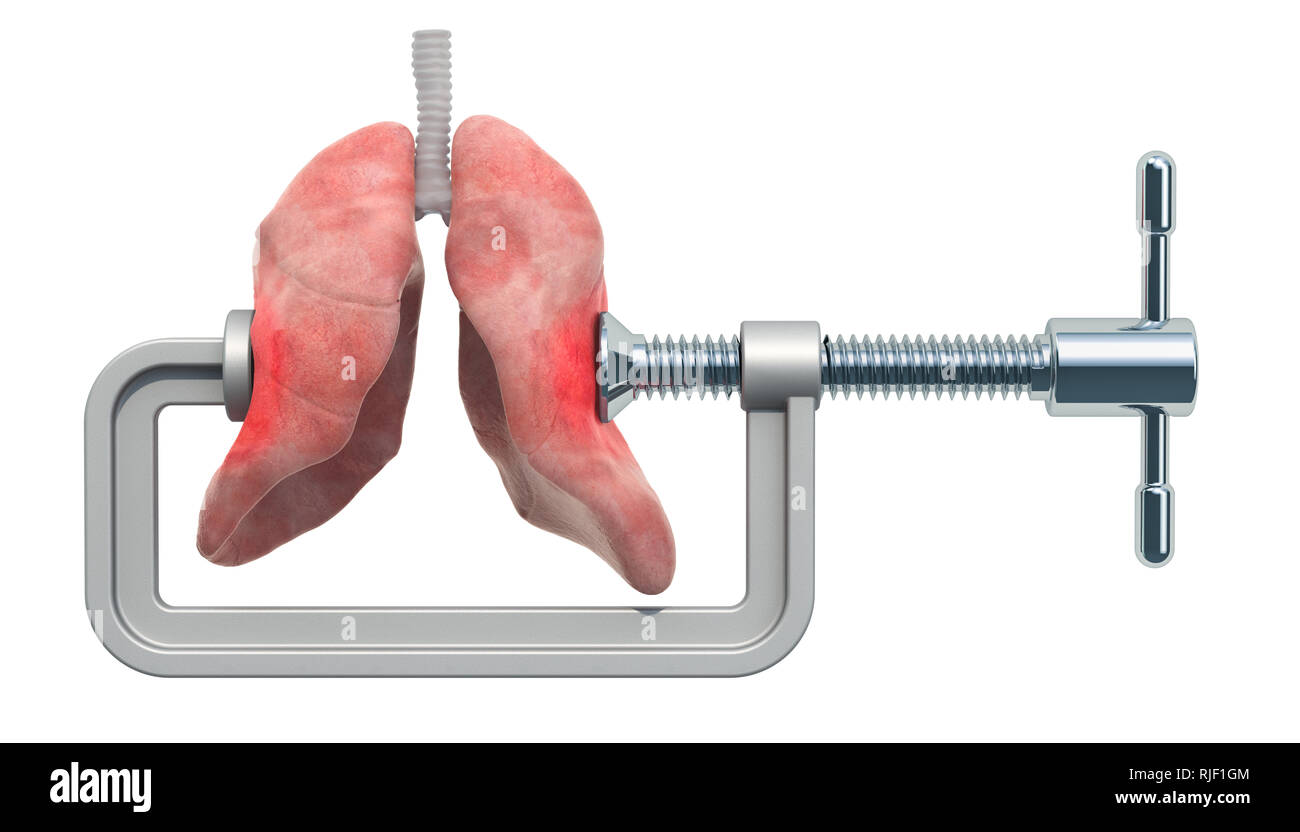 Schmerzen in der Lunge, Lungen Krankheit Konzept. Schraubstock mit menschlichen Lunge. 3D-Rendering auf weißem Hintergrund Stockfoto