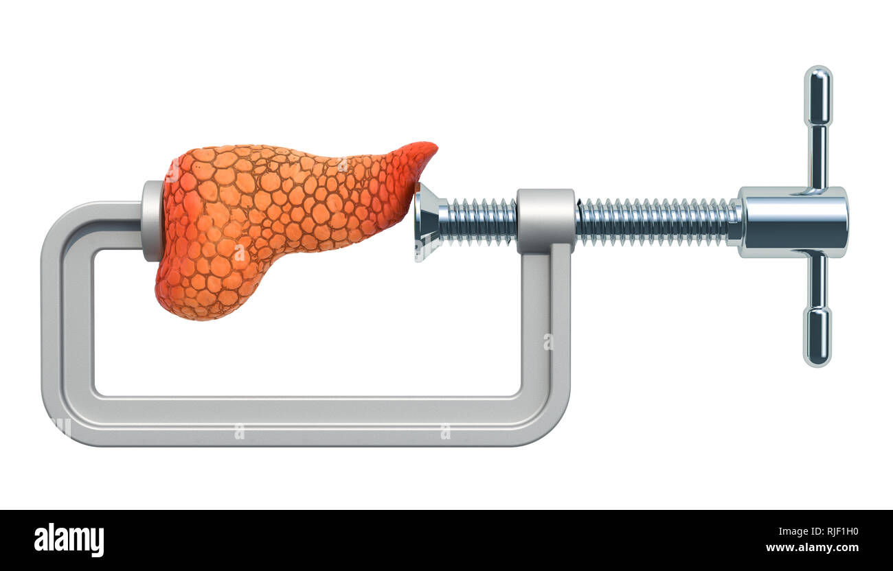 Pankreatische Schmerz. Schraubstock mit menschlichen Pankreas, 3D-Rendering auf weißem Hintergrund Stockfoto