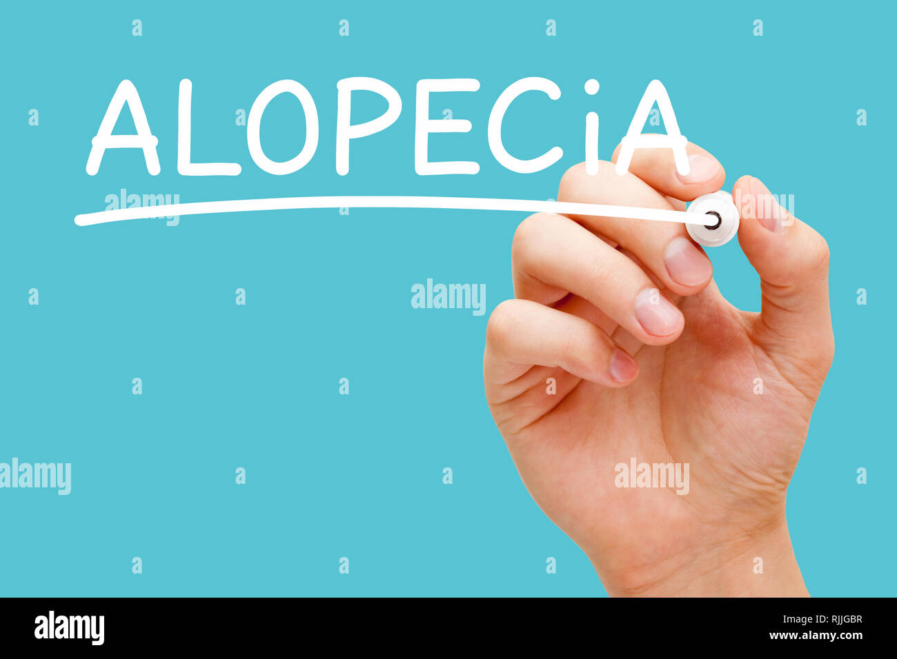 Hand schreiben Alopezie mit weißen Marker auf Transparenten abwischen Board auf blauem Hintergrund isoliert. Haarausfall oder Kahlheit Konzept. Stockfoto