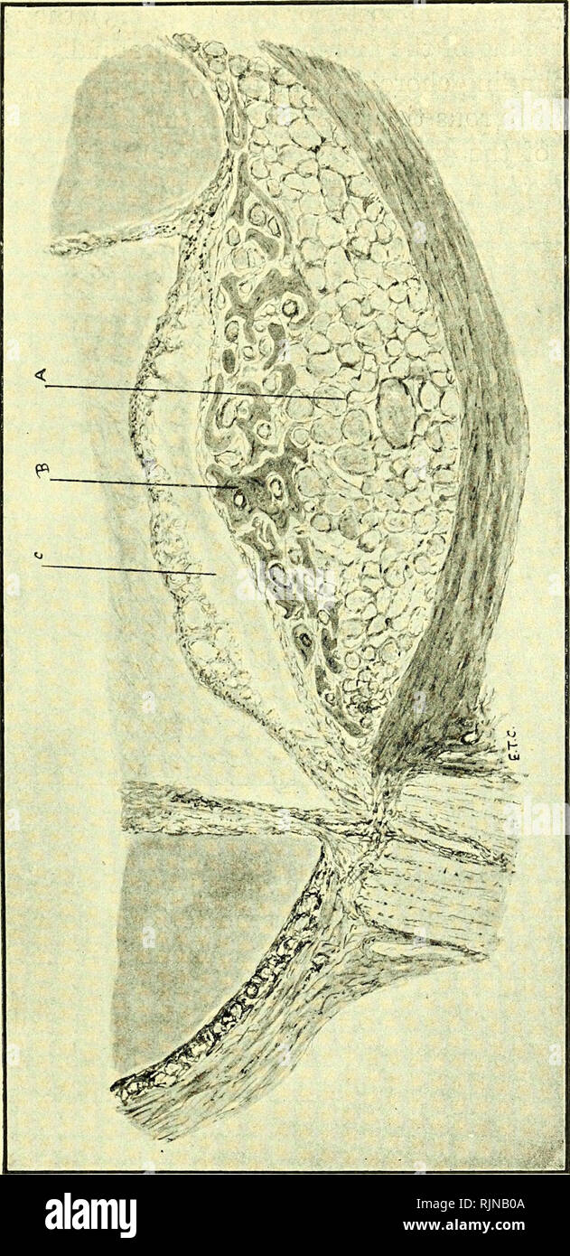 . Pathologie und Bakteriologie [elektronische Ressource]. Augenheilkunde; Auge; Auge; Bakteriologie; Augenheilkunde; Auge; Bakteriologie; Auge. INTKAOCULAR HEMANGIOMATA 21. Bitte beachten Sie, dass diese Bilder sind von der gescannten Seite Bilder, die digital für die Lesbarkeit verbessert haben mögen - Färbung und Aussehen dieser Abbildungen können nicht perfekt dem Original ähneln. extrahiert. Collins, E. Treacher (Edward Treacher), 1862-1937; Mayou, M. Stephen (marmaduke Stephen), 1876-1934; Pyle, Walter L. (Walter Lytle), 1871-1921, Herausgeber, University College, London. Bibliothek Dienstleistungen. London: William Heine Stockfoto