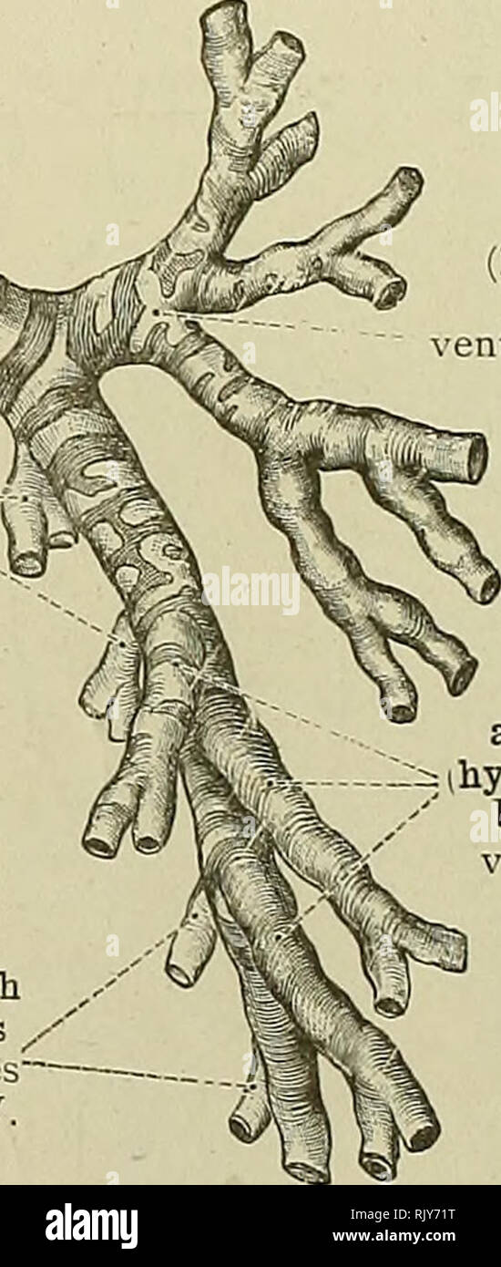 . Ein Atlas der menschlichen Anatomie für Studenten und Ärzte. Anatomie. "Cricoid Knorpel Knorpel Knorpel Cartilago cricoidea Erste tracheal trachealis I.^ Trachealen Knorpel-^ Cartilagines tracheales, ich eft Bronchus/Bronchus finstere der Ersten und Zweiten, dorsalen Zweige Rami dorsales bronchiales", I., II. Internen Verzweigung bronchialis Ramus medialis Dritten und Vierten dorsalen Zweige âRami bronclii-ales dorsales, III., IV. Dritte und vierte dorsalen Zweige/â Rami dorsales broncliiales, III., IV. Erste ventralen hyparterial) Zweig Ramus bronchialis ntralis I. (hyparteriali^ Zweite, Stockfoto