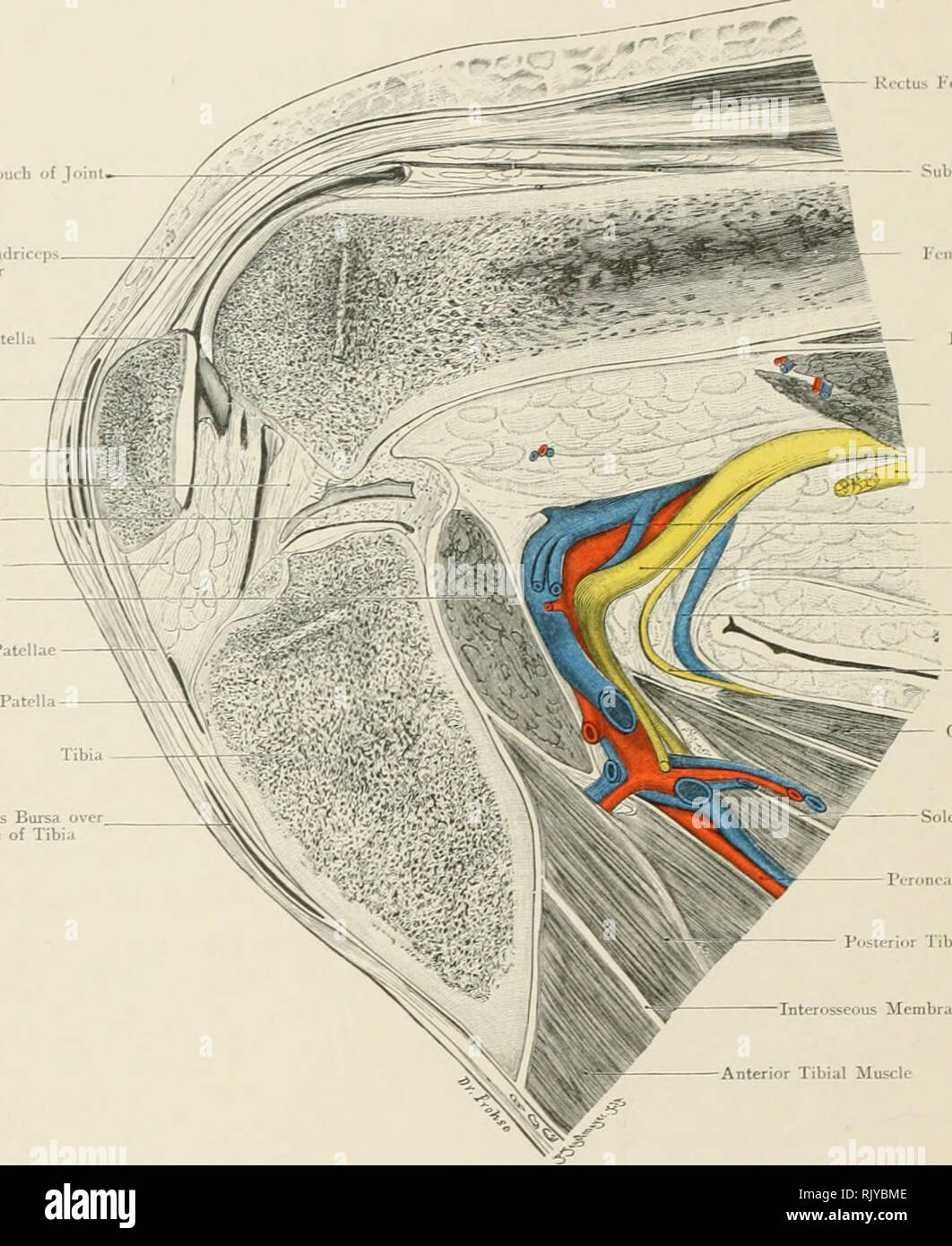 . Atlas der Angewandten (Topografische) menschlichen Anatomie für Studenten und Praktiker. Anatomie. Superior Puuth von Jnml Quadrict TcnJun der 'ps-Nsor Extt Patelli Subfascial Prcp. itolliir Bursa SubfuUneous Pr4i&gt; atellar Bursa Anterior entscheidende Ligament externe Taschenklappen Knorpel Ligamen drehen Mucosum Popliicus Muskel Ligamcntum Patellae tief Bursa unter Patella Subcutiint-ous Bursa o^tr. Tuberkel von Tibia. fctus Fcnioris Muskel Subcriireus Muscli - Jntcrnal M. vastus Muskel Kurze Leiter der Bizeps Musdc Kxtrrn. il I "opliU-al (Peronaeus) Nerv poplitea Schiffe Intern poplitea (Tibia) Nei-vc Kurze Saphenou Stockfoto