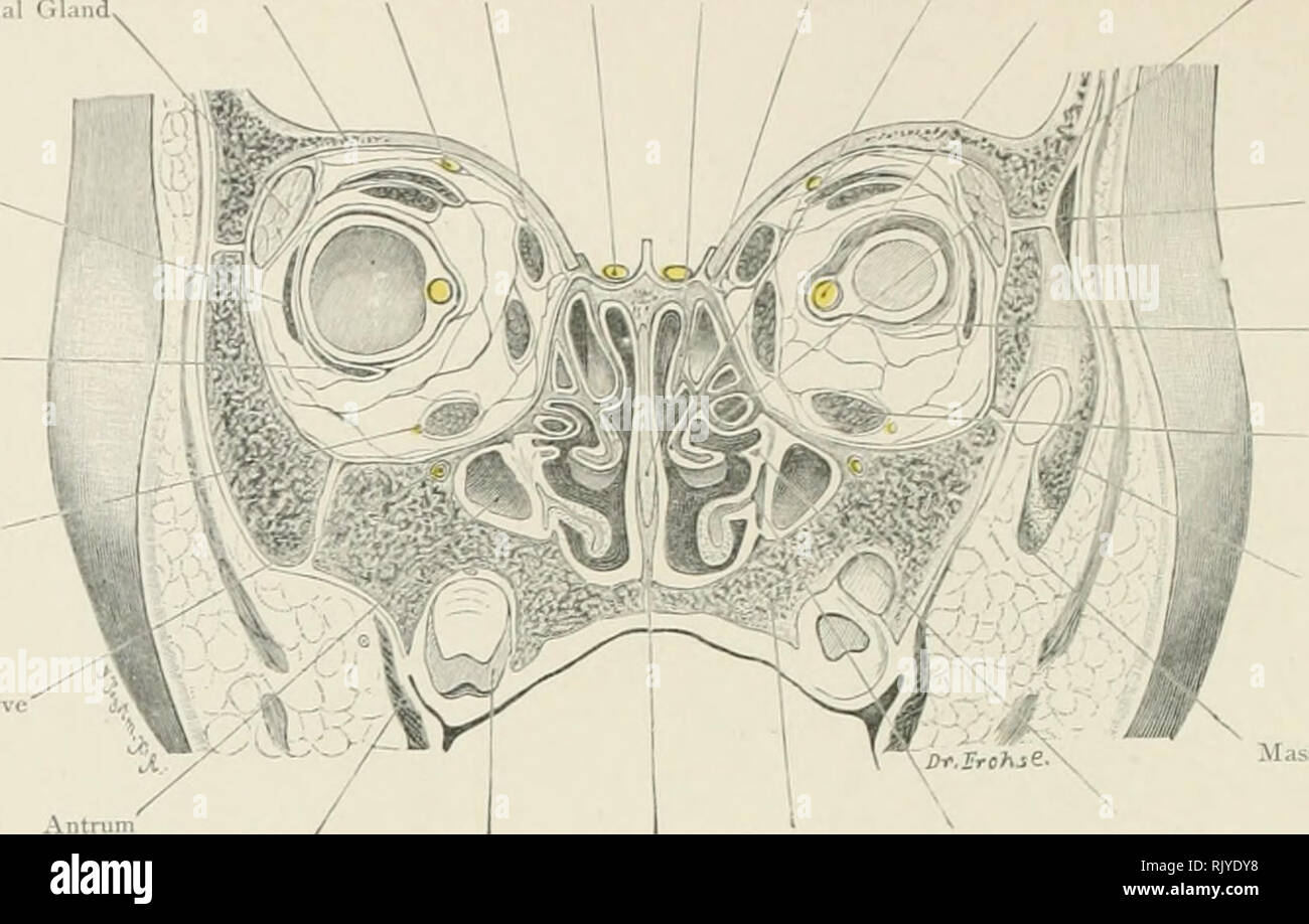 . Atlas der Angewandten (Topografische) menschlichen Anatomie für Studenten und Praktiker. Anatomie. Lacrymal Drüse. Superior Ol-Auto-^ Geige Tur-frontalen Schrägen Werk Turbinat - tilagc von binatcd Stirnbein Nerv Muskel Glühlampe'ed Knochen Septum Knochen Optik dienen" Aluscle Ethmoidal Bulla externe Rectus Inferior Schräg-Muskel minderwertig Abteilung der 3. Nerv Infra-orbital Xcrvc. - Der zeitliche Muskel Zapfen Kapsel • minderwertige Rt-ctus Muskel Zygoma Antrum Buccinator Massetfir Muskel Muskel Tempor; iry Vomer Oberkiefer minderwertig Uncinate Prozess Backenzahn Turbinated Knochen Abb. 43. Orbital und Nasale Stockfoto