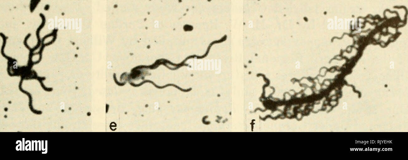 . Atlas der Bakterien Geißelung. Bakterien. 060 -/Nr. Abb. 40. Ein. Flavohacterium marinotijpicimi, Zobell (F-6). Eine unpolare flagellum von ziemlich langen Wellenlänge. Spiralkabel flagellen waren in dieser Kultur. F. suaveolens, ATCC (F-23). Peritrichous Flagellen der Normalen aber etwas kurzer Wellenlänge. c. e. Flavohacterium sp., Lyssenko Ac21. Peritrichous Flagellen der normalen Form und ziemlich lange Wellenlänge. d. Flavobacterium sp., Lyssenko BmEl. Peritrichous Flagellen der normalen Form. w. Flavohacterium sp., Stout K-8. Peritrichous Geißelung. Diese Kultur zeigten nur die geschweiften Art der Flagellen. Die meisten Stockfoto