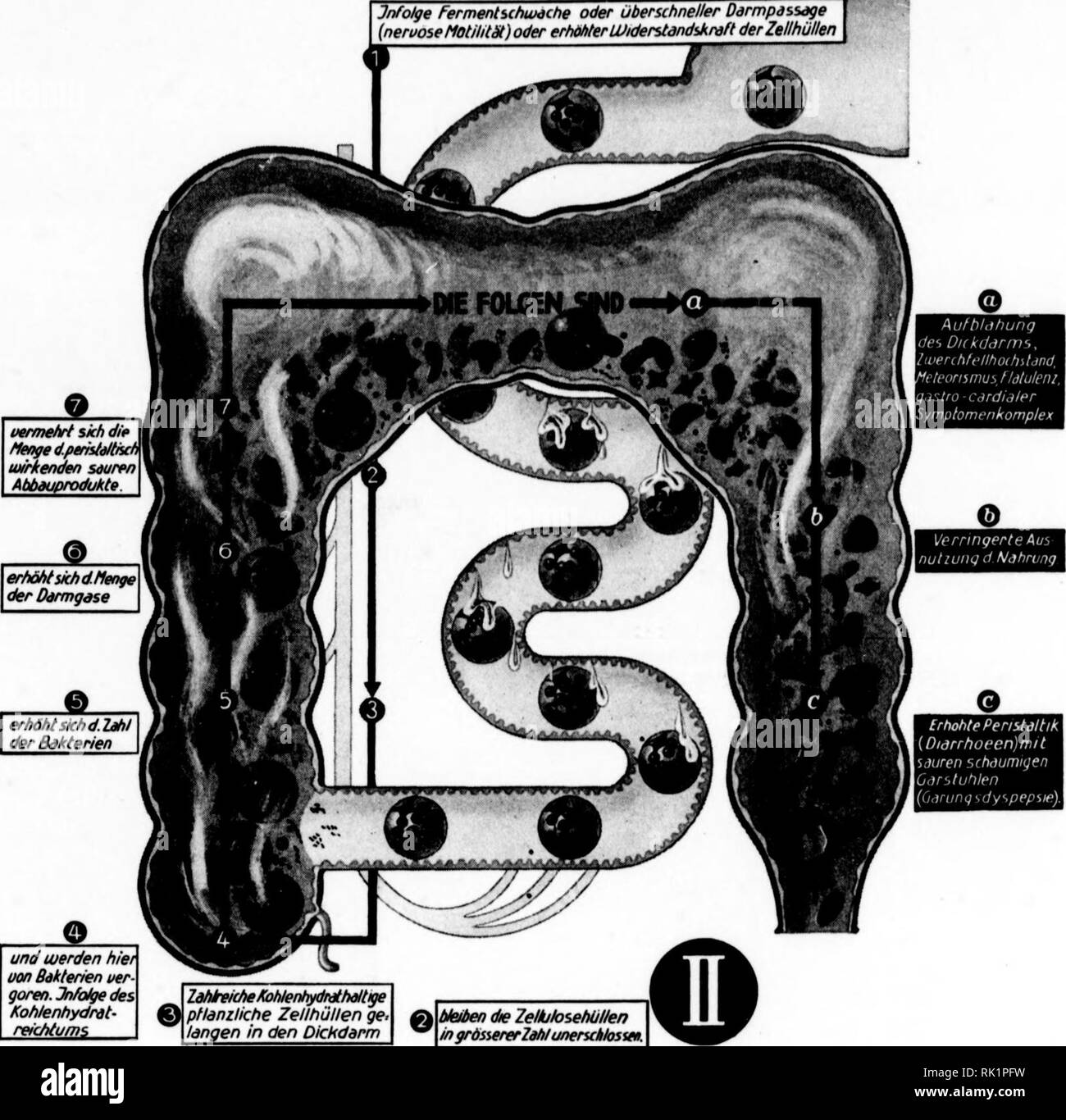 . Arthur und Fritz Kahn Sammlung 1889-1932. Kahn, Fritz 1888-1968; Kahn, Arthur David 1850-1928; Natural history Illustratoren; Natural History. Zur Frage der Luizym-Wirkung Verdauungsphysiologisches: oLuizym ist Sterben Frucht mehrjähriger Enzym-chemischer, L/pflanzenphysiologischer und klinischer Studien. Wie aus den einführenden Arbeiten hervorgeht, zeichnet sich dos Verdauungs-Enzym-System Luizym vor allem dadurch aus, daß es zum ersten Male auch Zellulose- und hemizel lulosespa Itende Enzym mit enzymatischer und durchgreifender therapeutischer Wirkung enthält: Die GUS Zellulose und Hemize Stockfoto