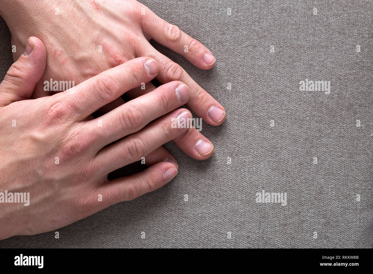 Nahaufnahme der männlichen männliche Jugendliche Arbeiter Hände mit rauher Haut und kurze Fingernägel auf ebenem Kopie Raum Hintergrund, Ansicht von oben. Die manuelle Arbeit und Stockfoto