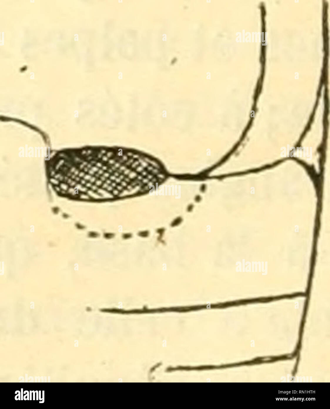 . Annales de la Société entomologique de France. Insekten; Entomologie. 146 D--A. SiCARD.de la moitié Aux Quatre cinquièmes delà Länge et couvrant les deux Tiers médiaires de la largeur. Dessous d'un Brun châtain plus Clair sur l'Abdomen; Les pattes sind Jau-nes, avec Les quatre cuisses postérieures rembru-Nies. Légèrement prosternum Convex sur la ligne Mediane, sans carènes, avec un Léger rebord Le Long des hanches antérieures. Métasternum Convex, Lui - Sant, sans Sillon. Plaketten abdominales prolongées jusqu'Aux Trois Quarts de larceau. - Lange. : 1,7 miUim. Tamatave (M"''' Grlner, Stockfoto