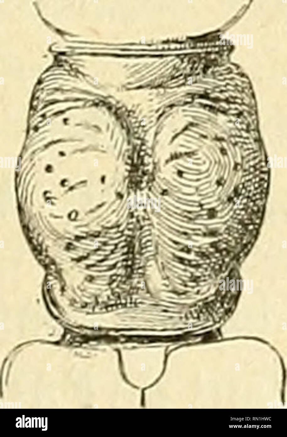 . Annales de la Société entomologique de France. Insekten; Entomologie. (223; Cérambycides de la région de Jataliy. 121 partir du rétrécissement basilaire, puis globuleux, est Presque- criblé entière de Punkte petits et serrés, c'est-à-dire que les Plaques latérales se soudent sur la ligne Mediane du Halsschild, isolant seule- quelques espaces Lisses, un situé au Centre de la Base, lancéolé, Gericht et konkav, deux Medic, du Doppelzimmer plus Longs que le Pre-Mier, un peu Arqués, cicatrisés çà et là et terminés chacun par un stigmate arrondi; En outre, sur les Bords latéro - antérieurs, il y Stockfoto