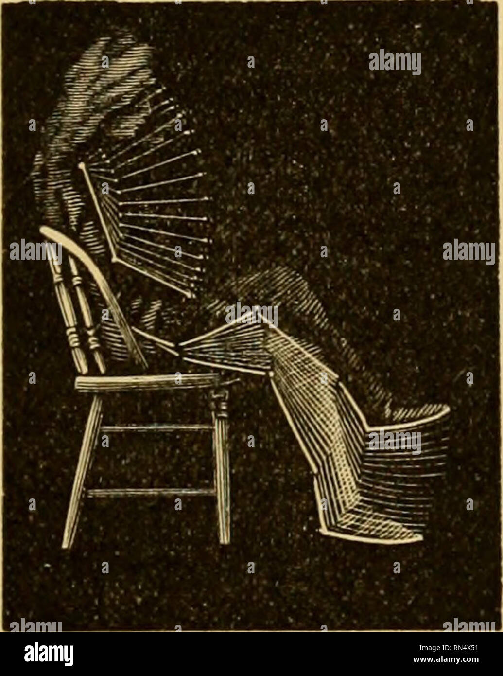 . Animal locomotion: der muybridge Arbeiten an der Universität von Pennsylvania: die Methode und das Ergebnis. Eadweard Muybridge,, 1830-1904; Pferde; Tier Fortbewegung; Fotografie, augenblicklich. Normale und Anormale Bewegungen. 131 extrem langsam und dass die Arme waren sehr steif. Wenn Sie wurde aufgefordert zu gehen, sie zeigte eine deutliche Tendenz nach vorne zu fallen. Der Kopf war nicht von dem Beben betroffen, und wurde in eine Starre, feste Position durchgeführt. Der Patient nie drehte ihren Kopf, es sei denn, speziell dazu aufgefordert werden. Der tremor schien sehr rhythmisch, und wenn der Verfasser das erste Mal sah ihn der Patient ganz verschwinden Stockfoto . Animal locomotion: der muybridge Arbeiten an der Universität von Pennsylvania: die Methode und das Ergebnis. Eadweard Muybridge,, 1830-1904; Pferde; Tier Fortbewegung; Fotografie, augenblicklich. Normale und Anormale Bewegungen. 131 extrem langsam und dass die Arme waren sehr steif. Wenn Sie wurde aufgefordert zu gehen, sie zeigte eine deutliche Tendenz nach vorne zu fallen. Der Kopf war nicht von dem Beben betroffen, und wurde in eine Starre, feste Position durchgeführt. Der Patient nie drehte ihren Kopf, es sei denn, speziell dazu aufgefordert werden. Der tremor schien sehr rhythmisch, und wenn der Verfasser das erste Mal sah ihn der Patient ganz verschwinden Stockfoto