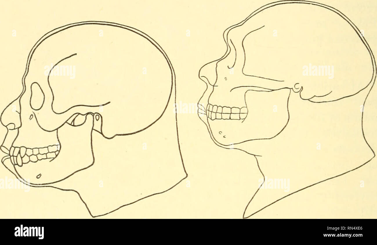 . Biologie der Tiere. Biologie; Zoologie; Physiologie. 434 Biologie der Tiere mously dicken Schädel Wände dieses piltdown Mensch, Eoanthropus daivsoni, ähneln denen der Peking Mann, aber die Stirn und Gewölbe der Schädel Ansatz näher, dass der moderne Mensch. Die Kiefer und canine Zahn mehr Affenähnlichen als in der Mann von Peking, und wahrscheinlich nicht auf die gleiche Skelett gehören. Obwohl geologisch über gleichzeitigen, ist es schwierig, aus den spärlichen Daten die relativ große-brained Piltdown Menschen in Beziehung mit der Java und Peking Männer zu bringen. Es hat sug - gested, dass die Hum Stockfoto