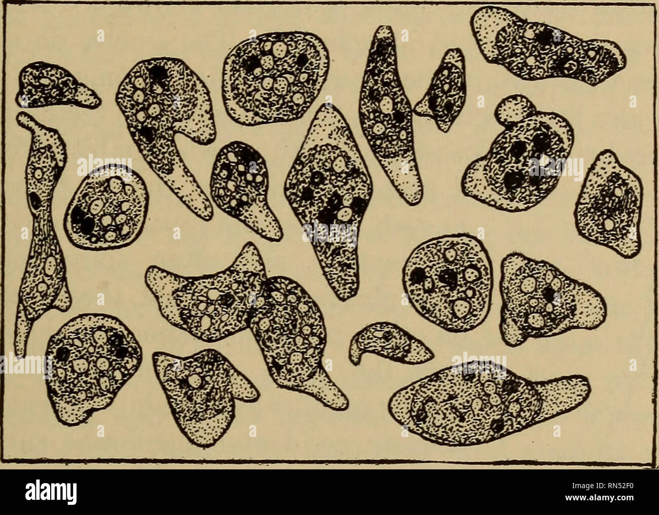 . Tierische Schädlinge und Krankheiten. Medizinische Parasitologie ; Insekten als Überträger von Krankheiten. AMEBiE DER MUND 141 endoplasm in späteren Ausgießen. Die Reproduktion dieser kleinen Tiere wird durch eine einfache Aufteilung des Körpers in zwei wenn Sie groß genug zu fühlen, schwerfällig, als einzelne Individuen. Obwohl Zysten sind für den Schutz gegen gebildet. Abb. 41. Gemeinsame Formen der Endamoeba gingivalis, aus menschlichem Mund. X650. (Nach Bass und Johns.) Eine ungünstige Umwelt, keine Multiplikation innerhalb der Zysten wurde beobachtet, wie etwa der Endamceba coli oder E. histolytica. Die c Stockfoto
