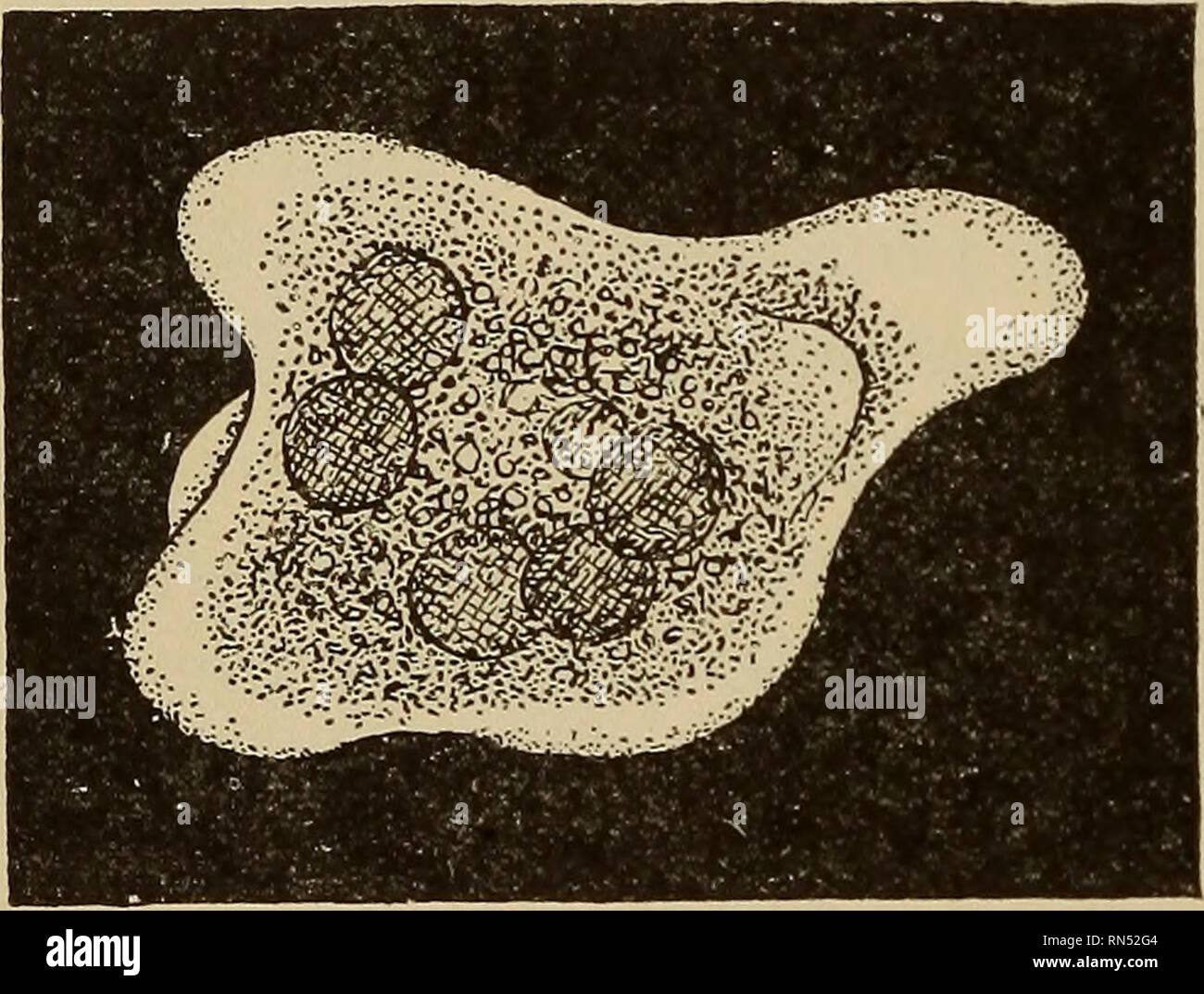 . Tierische Schädlinge und Krankheiten. Medizinische Parasitologie ; Insekten als Überträger von Krankheiten. 132 AMEBiE getragen in einer langen Reihe von experimentellen Fütterungen mit amebse verschiedener Arten und weitgehend als Ergebnis ihrer Arbeit die wahren Tatsachen des Falles entwirrt wurden. Sie erwiesen sich als die Unschädlichkeit des Endamceba coli und zeigte auch, dass E. histolytica und E.tetragena, lange Zeit als unterschiedliche Arten, sind wirklich zwei Phasen der eine Art. Die dysenterie Amöben. - Die Ruhr ameba, E. histolytica (Abb. 37), ist groß und aktiv und 25 bis 40 ju (T^W s^Zoll) im Durchmesser, mit einem eher Stockfoto