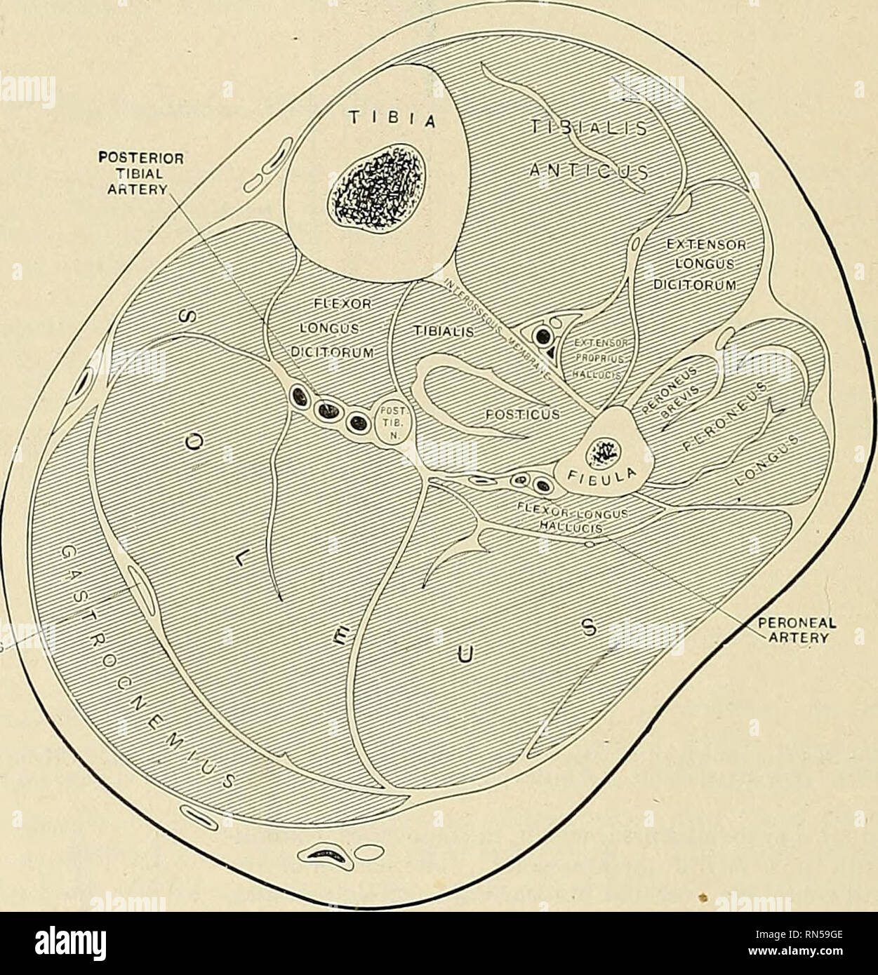 . Anatomie, beschreibende und angewendet werden. Anatomie. 530 die Muskeln und Faszien allmählich immer dicker und enger, verbindet mit der Sehne des Gastroc - nemius und bildet mit ihm die tendo Achilis. Beziehungen.-Durch seine oberflächlichen Oberfläche, mit der Gastrocnemius und deef Plantaris; durch seine Oberfläche, mit der flexor digitorum Longus, Flexor hallucis longus, Tibialis posterior tibial posticus, Gefäße und Nerven, von dem er durch die transversale intermuscular Septum oder Tiefe quer Faszien des Bein abgetrennt ist. Die Tendo Achilis {Tendo calcaneus), die gemeinsame Sehne des Gastrocnemius und Sol Stockfoto
