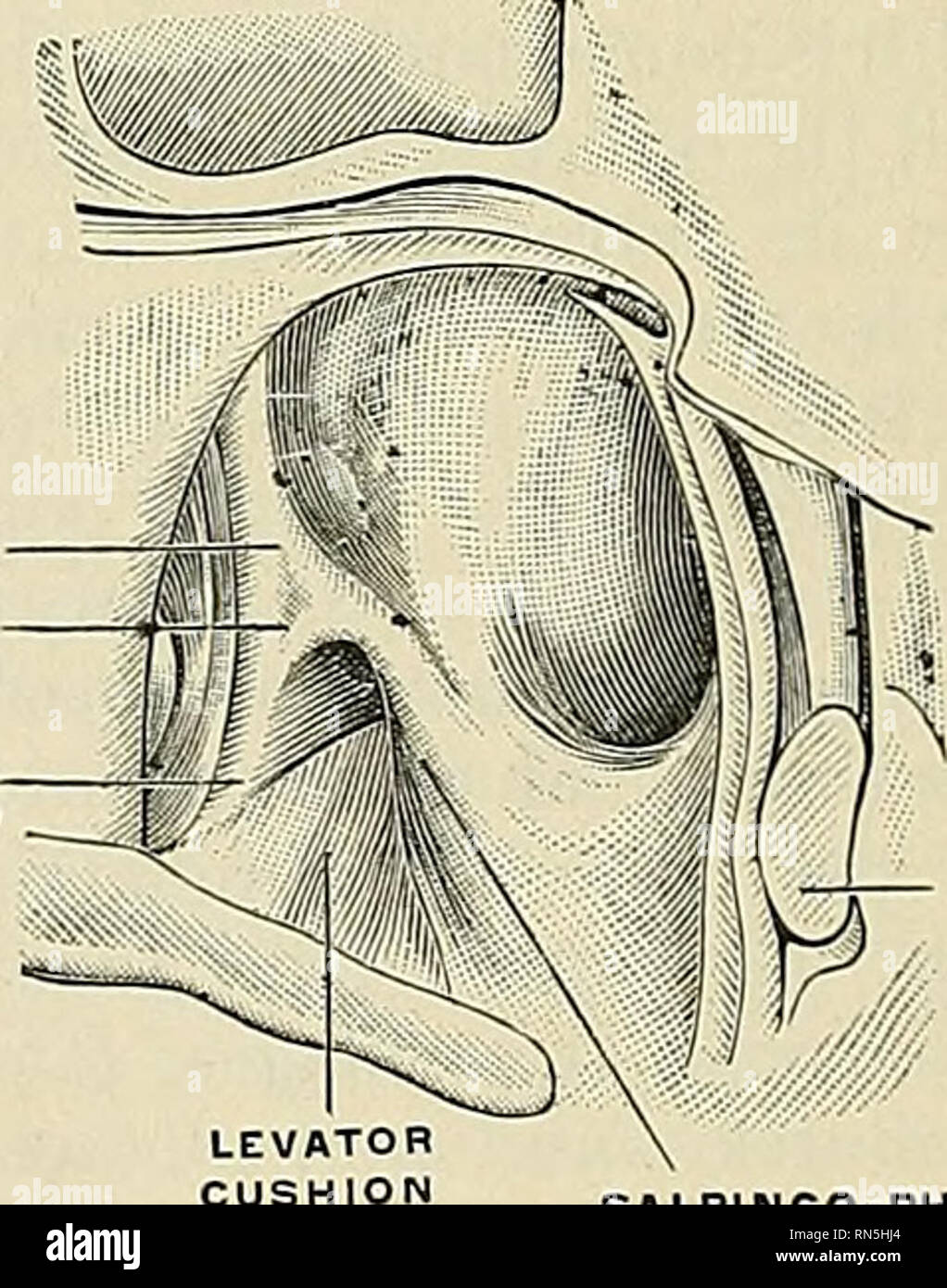 . Anatomie, beschreibende und angewendet werden. Anatomie. SALPINGO-NASAL FALTEN EUSTACHISCHE-Kissen. - Tonsilla pharyngealis in einem Erwachsenen. (Escat.) GEAL FALTEN Abb. 961.- Der posterioren lateralen Hohlraum Der naso-Rachen. (Escat.) Die gaumenmandeln (Tonsilla palatina) (Abbn. 963 und 964) sind zwei der lymphatischen Organe liegt eine auf jeder Seite der Schlund, zwischen den vorderen und hinteren Säulen der weiche Gaumen, entsprechende in Position nach außen, um den Winkel des Unterkiefers. Sie sind in der Regel eine ovale Form als von Ihren mündlichen Aspekt gesehen, und unterscheiden sich wesentlich in der Größe in verschiedenen Individuen. Wie in horizontalen gesehen Stockfoto