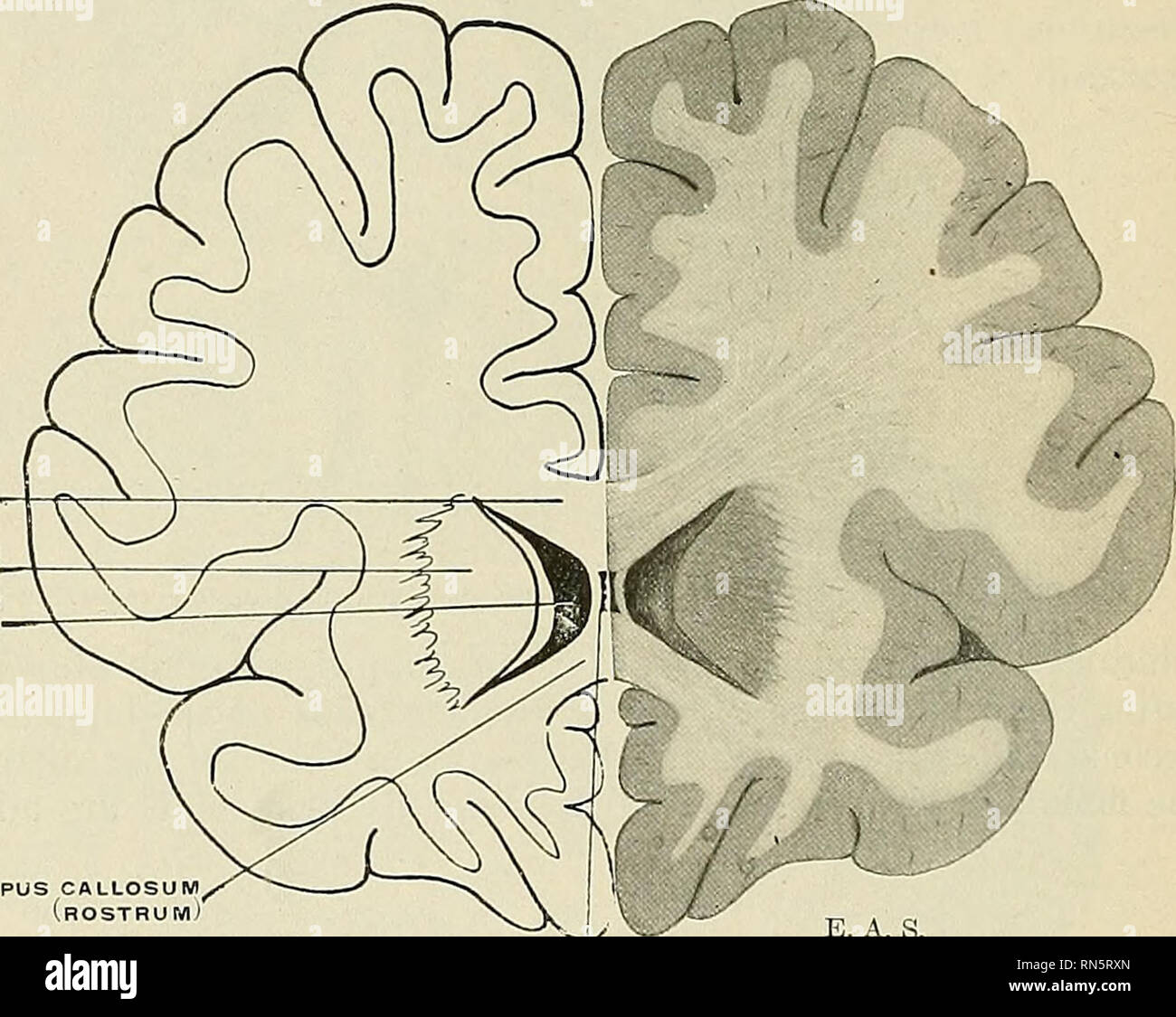 . Anatomie, beschreibende und angewendet werden. Anatomie. 944 DAS NERVENSYSTEM hinteren Säulen oder crura fornicis. Die Mehrheit der Fasern weiter frontad in jeder Hälfte Fornix, aber einen Kurs Anzahl quer der Crus fornicis auf der gegenüberliegenden Seite Eintragen in der hippokampalen Formation zu beenden. Diese Fasern, quer, bilden eine dünne Lamelle Ausfüllen der kleinen dreieckigen Platz im subsplenial Region zwischen den Konvergierenden crura fornicis und bilden im Hippocampus commissure (Lyra, Psalterium). Gelegentlich eine kleine Aussparung nannte die Verga Ventrikel ist zwischen den Corpus callosum Ein gebildet Stockfoto