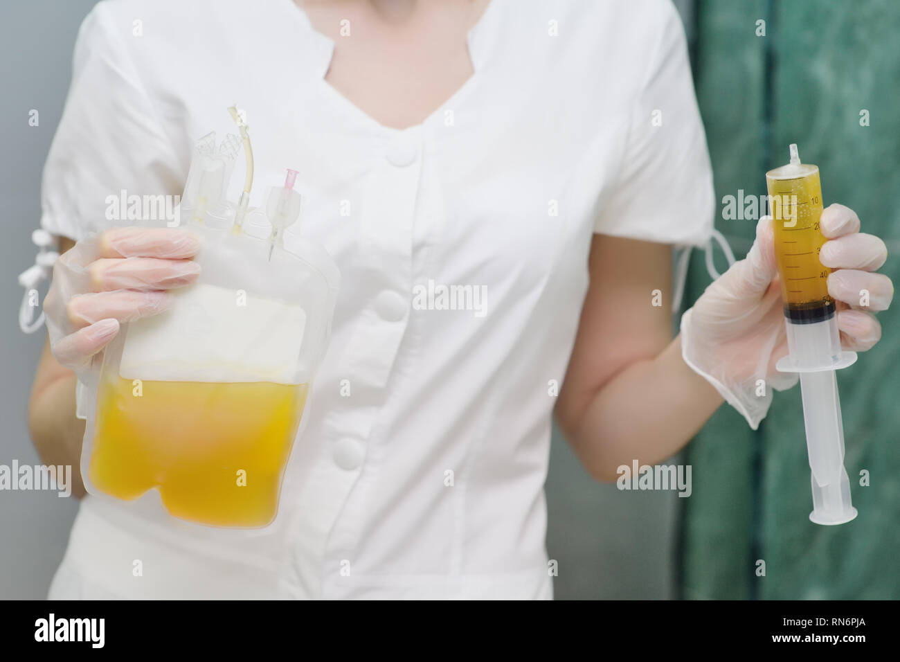 Medizinische Container mit Plasma in den Händen einer Krankenschwester Stockfoto