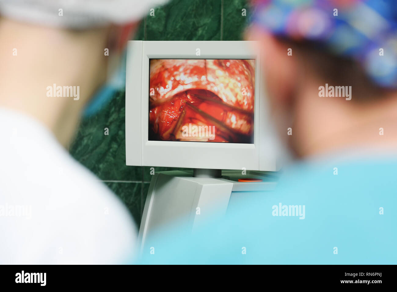 Neurochirurgen beobachten Gehirn Chirurgie in einem Monitor Stockfoto