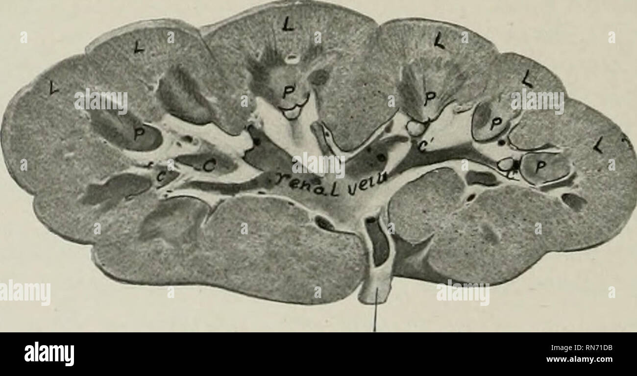 . Die Anatomie der Haustiere. Veterinär Anatomie. Vordere Extremität Harnleiter Nierenarterie Abb., 504.- rechten Niere o: Orgel in ditu gehärtet. Fat baa wurde ich zwischen den Lappen. Nierenarterie Abb. 505.-FRONTALEN. Abschnitt des Kibnet der Ochse. L, Lappen der Cortes; P, papille;;;;;;;; C, Kelch große; c', calyces transversale Prozesse, aber seine e. xtremities kann ventral der Ersten und Vierten lumbalen Quer verarbeitet werden. Die rückenseite ist gerundet, und ist vor allem in Kontakt mit dem sublumbar Muskeln. Die ventrale Oberfläche ist weniger konvex, antl ist in die Leber, Pankreas, duocienum und Doppelpunkt. Die hi Stockfoto