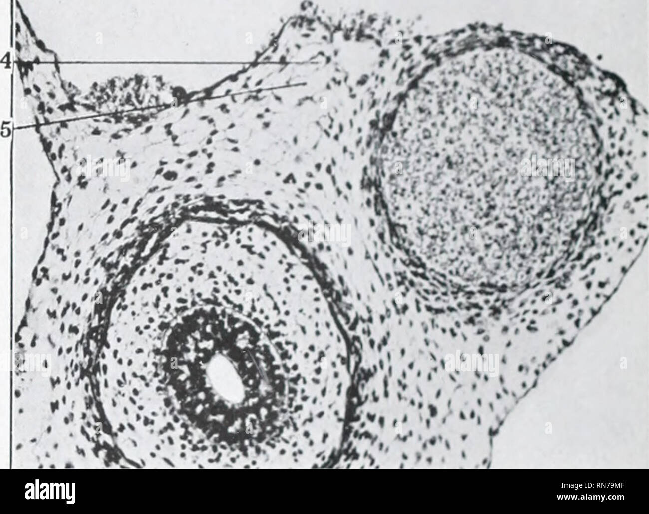 . Die Anatomie und die Entwicklung der systemischen Lymphgefäße in der Hauskatze. Katzen; Lymphatics. 224 Abhandlung Nr. L HVNTIXGTON, 1911. t', '^'. • • • • "'r 223. Bitte beachten Sie, dass diese Bilder sind von der gescannten Seite Bilder, die digital für die Lesbarkeit verbessert haben mögen - Färbung und Aussehen dieser Abbildungen können nicht perfekt dem Original ähneln. extrahiert. Huntington, George Sumner, 1861-1927. Philadelphia Stockfoto