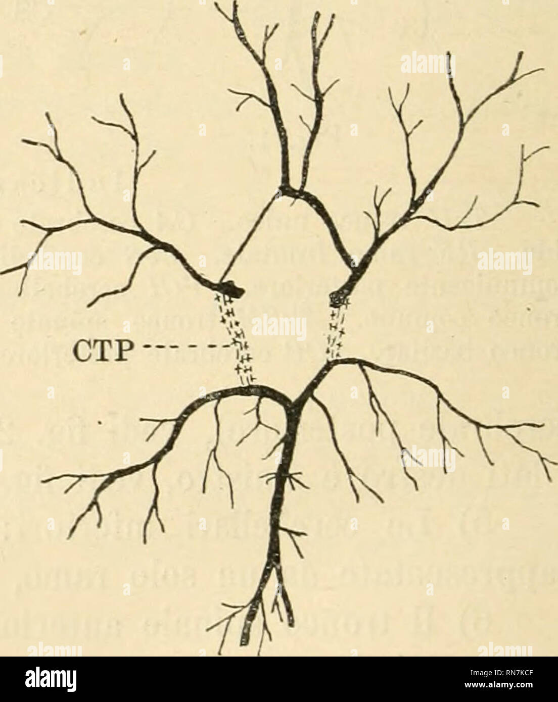 Paralisi cerebrale Fotos und Bildmaterial in hoher Auflösung Alamy