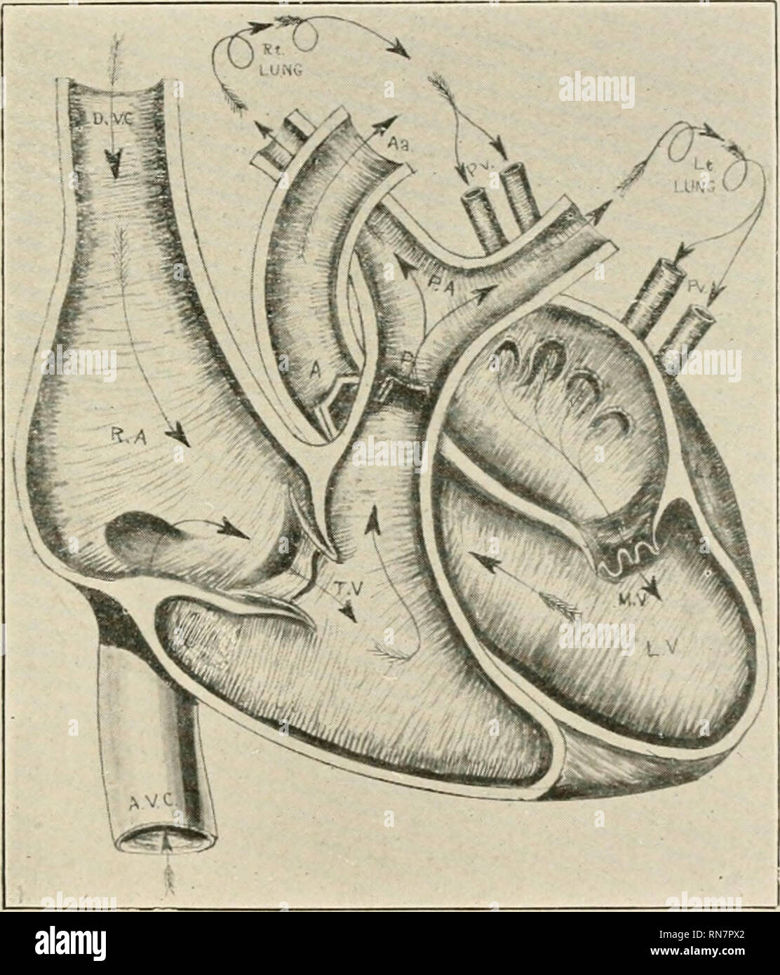 . Anatomie auf den Punkt: Eine Abhandlung über die Anatomie des Menschen in seiner Beziehung zu Osteopathie. Die menschliche Anatomie; osteopathische Medizin osteopathische Medizin; Anatomie. Anatomie in einer Nußschale. 297 Zweigstellen, die durch die sphenoidal Riss und zeitlichen Zweige, die durch Steingrab in der großen Flügel des Sphenoid auf die zeitliche Fossa bestanden haben. (4) Kleine meningealen kann eine Filiale der mittleren Hirnhaut. Es geht durch das Foramen ovale in den Gasserian Ganglienzellen. (5) geringer zahnmedizinische Pässe mit dem Innenraum zahnmedizinische Nerv des fünften Hirnnerven in das Minderwertige zahnmedizinische Kanal zur geistigen Foramen Stockfoto