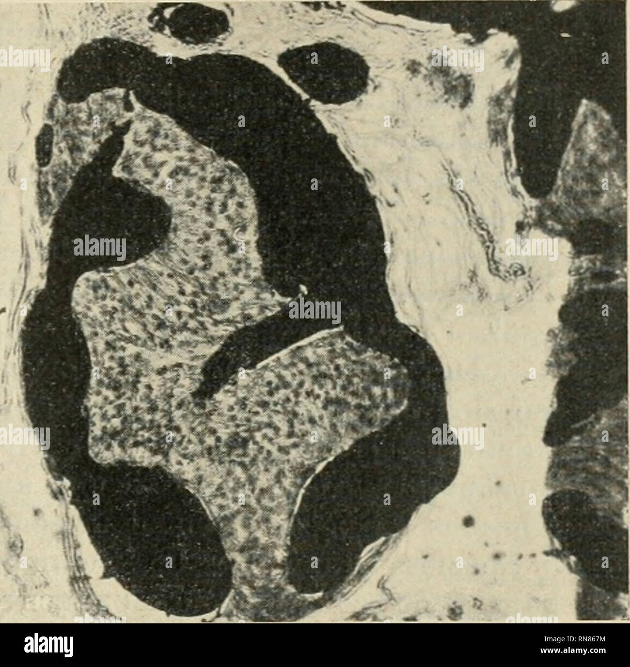 . Anatomischer Anzeiger. Anatomie, Vergleichende; Anatomie, Vergleichende. Abb. 3. Dieselbe Korrosion wie Abb. 1. Abb. 4. Von ventral sterben gesehen, besonders Abb. 3 venösen Bahnen der Nebenniere gezeigt. 2,5 mal vergrößert Bild. 4. Ein Schnitt der mit Tusche injizierten Nebenniere. Zwischen den Lappen und den Gefäßwänden zerstreut liegen, auch in das am nächsten anliegende Gefäßlumen hineinfließt. 3) Sterben Verästelungsweise der Venen im Hoden ist auch nicht ohne Interesse zu erwähnen (Abb. 1und 3). Der Hoden des betreffenden Tieres ist eigentlich aus vielen scheibenförmigen Lappen aufgebaut, welche vor Stockfoto