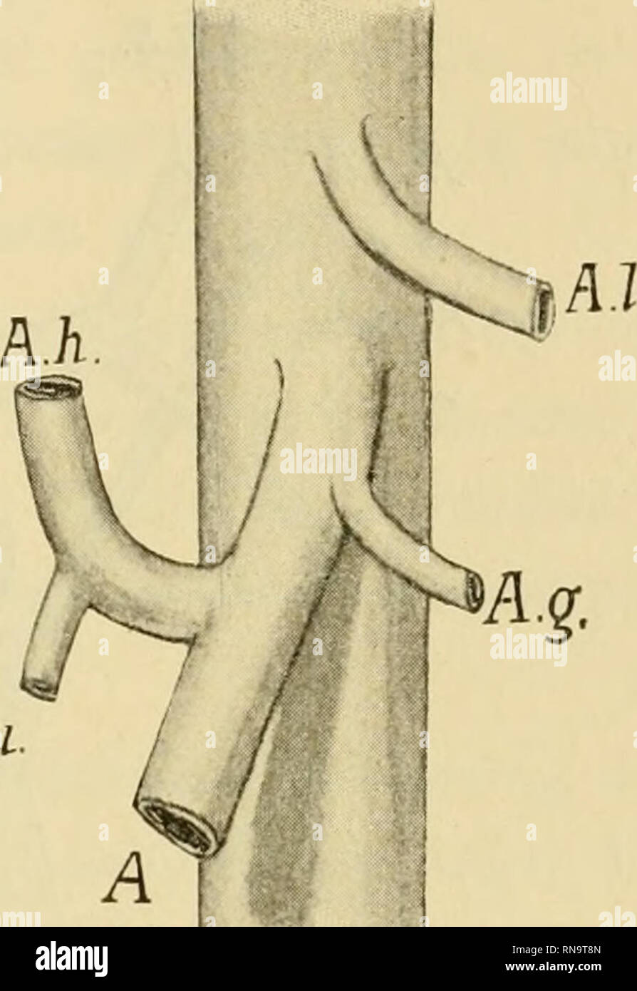 Arteria gastroduodenalis Fotos und Bildmaterial in hoher Auflösung