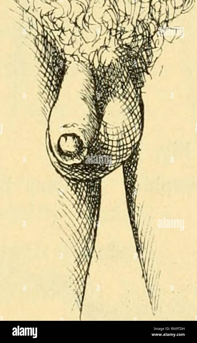 Anatomische Hefte. Anat. - archolog. Studien. Iii. Infibulation b Sterben.  Griechen u. Rmern. 237 zurckgetretenen Vorhaut wie von einem Ring  (Annulus prae-putialis) umgeben ist. Es sieht der betreffende Teil wirkhch  so