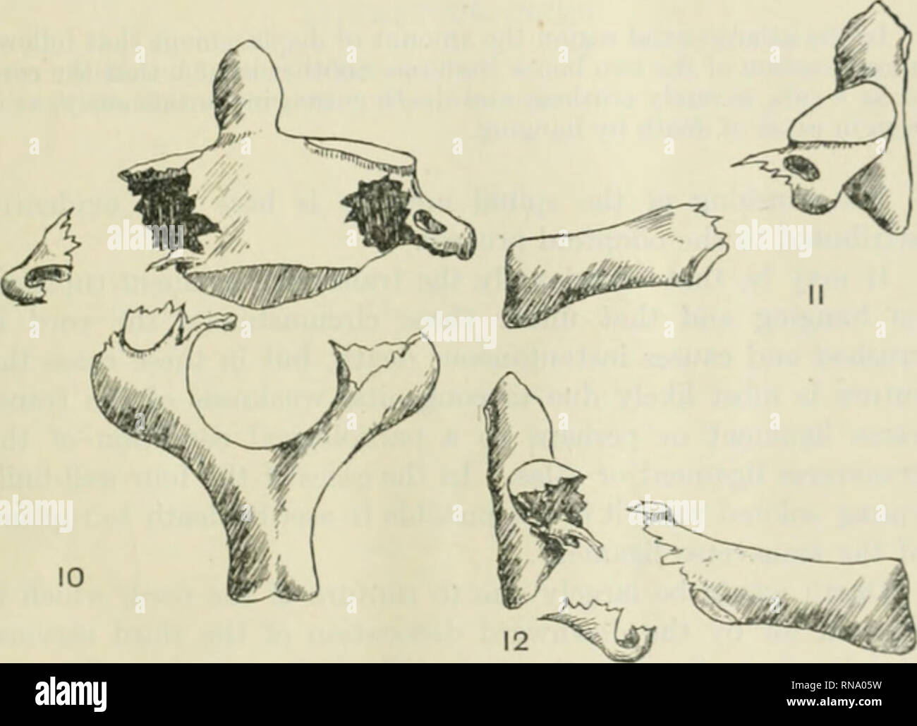 . Die anatomischen Datensatz. Anatomie; Anatomie. Die FRAKTUR DES EPISTROPHEUS 309 Oberfläche. Darüber hinaus wurde festgestellt, dass der Atlas auch wurde verstümmelt, die quer liegenden Prozess ofT von der seitlichen Masse, der Bruch wird durch die Wurzeln der trans-Vers und Elemente. Die trans' erse Prozess selbst war auch in drei Teile zerbrochen. In Grey's Anatomy, Seite 358, finden wir die folgende Aussage:. Abb. 10 Körper und neuronalen Arch der Wirbel. Tanne. 11 Teile der Wirbel von der rechten Seite gesehen. Abb. 12 Teile der Wirbel auf der linken Seite gesehen. Dislokation von Th Stockfoto