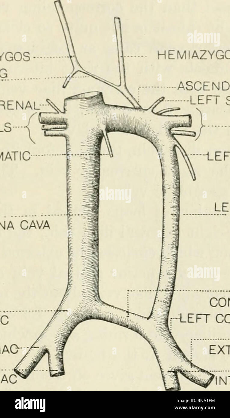 . Die anatomischen Datensatz. Anatomie; Anatomie. Die Vervielfältigung von Vena cava inferior 477 Links, Vena cava inferior; 5 cm. schlechter als die der Eingang des großen vorderen renal Vein (Abb. 1). Im Herbst 1911 ein Zustand ähnlich der ersten in einem anderen Thema (Nr. gefunden wurde. 401, Cornell Serie), einen weißen Mann, im Alter von 50 Jahren, die der zirrhose der Leber enthalten. Auf der rechten Seite der A. iliaca Vene auf der Ebene der anterior superior Darmbein Wirbelsäule durch die A. iliaca Vene verbunden ist die AZYGOS ANASTOMOSING BEREICH RECHTS NEBENNIERENHORMONEN SPERMATIC RENALS rechts mit der rechten Vena cava inferior RECHTS GEMEINSAME DARMBEIN R zu bilden Stockfoto