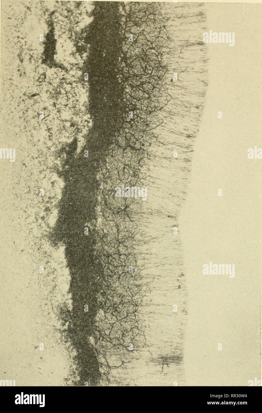 . Die actinomyceten: ihrer Art, auftreten, Aktivitäten und Bedeutung. Aktinomyceten; Actinomycetales. Abb. 6.-Nocardia asteroides, auf Pi^itato Glukose gewachsen - Beef extract Agar, Gram-Färbung, X100. CPre "Pared hy Littman der Bundeswehr Institut für Pathologie). Bitte beachten Sie, dass diese Bilder sind von der gescannten Seite Bilder, die digital für die Lesbarkeit verbessert haben mögen - Färbung und Aussehen dieser Abbildungen können nicht perfekt dem Original ähneln. extrahiert. Waksman, Selman A. (Selman Abraham), 1888-1973. Waltham, Mass., Chronica Botanica Co. Stockfoto