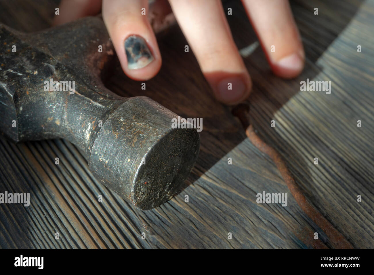 Verletzte hand mit Geschwärzter und gequetschten Thumbnail vom Heftig schlagen Sie über einen Hammer in der Nähe zu sehen, in einem konzeptionellen Bild der DIY-Verletzungen Stockfoto