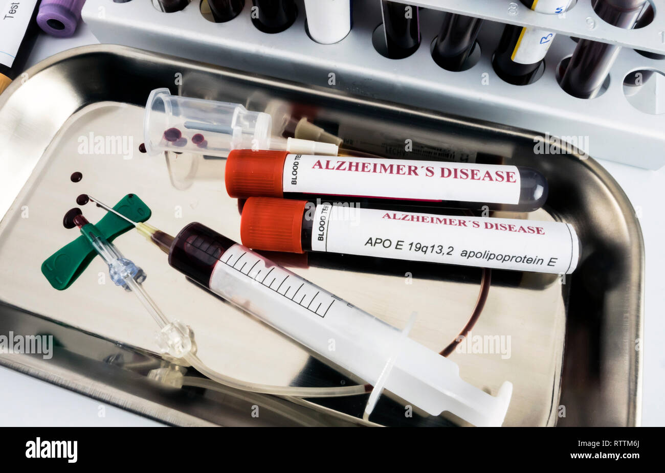 Blutprobe Abhilfe zu schaffen gegen die Alzheimer Krankheit untersuchen, konzeptionelle Bild Stockfoto